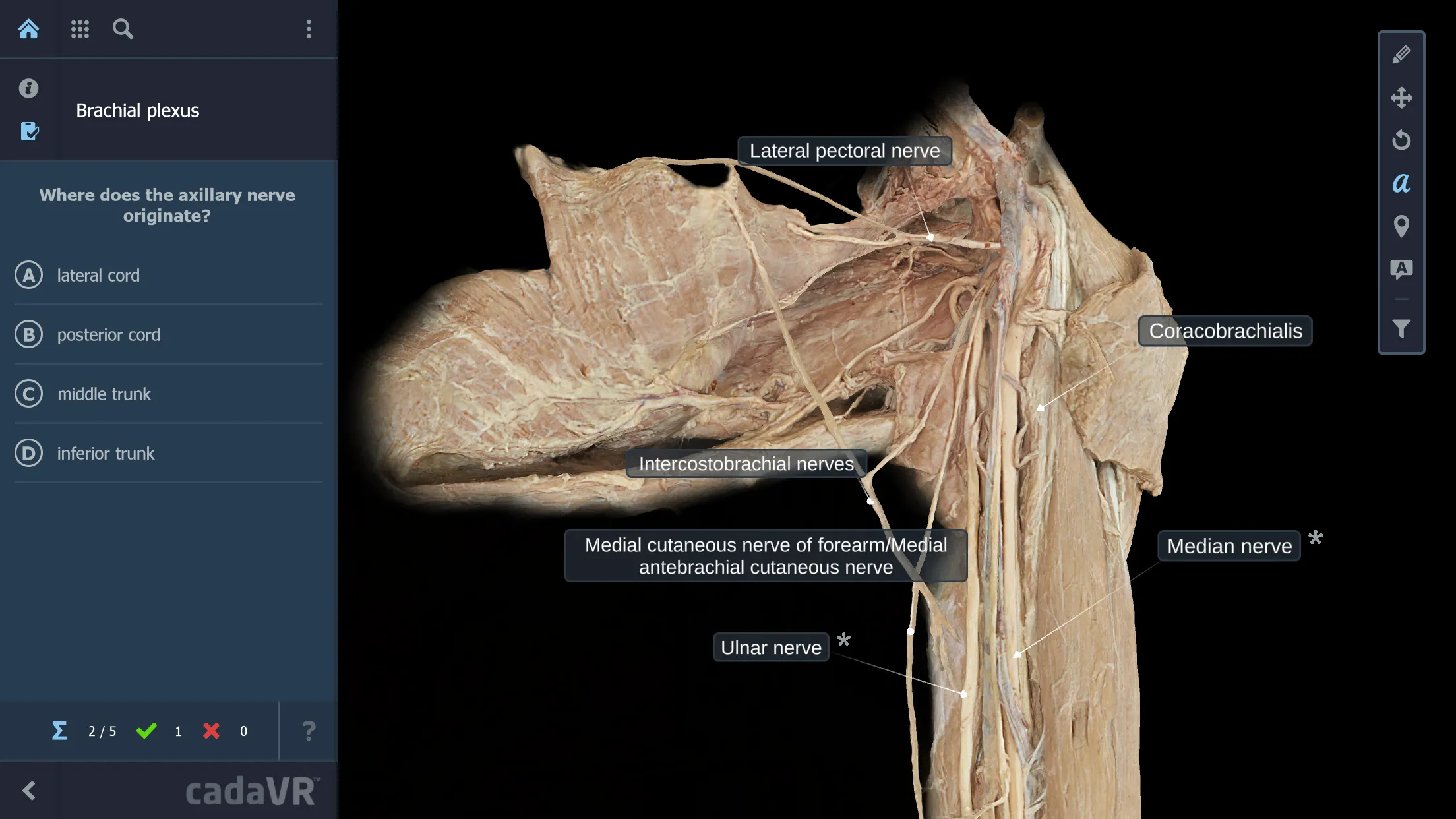 cadaVR anatomy | Indus Appstore | Screenshot