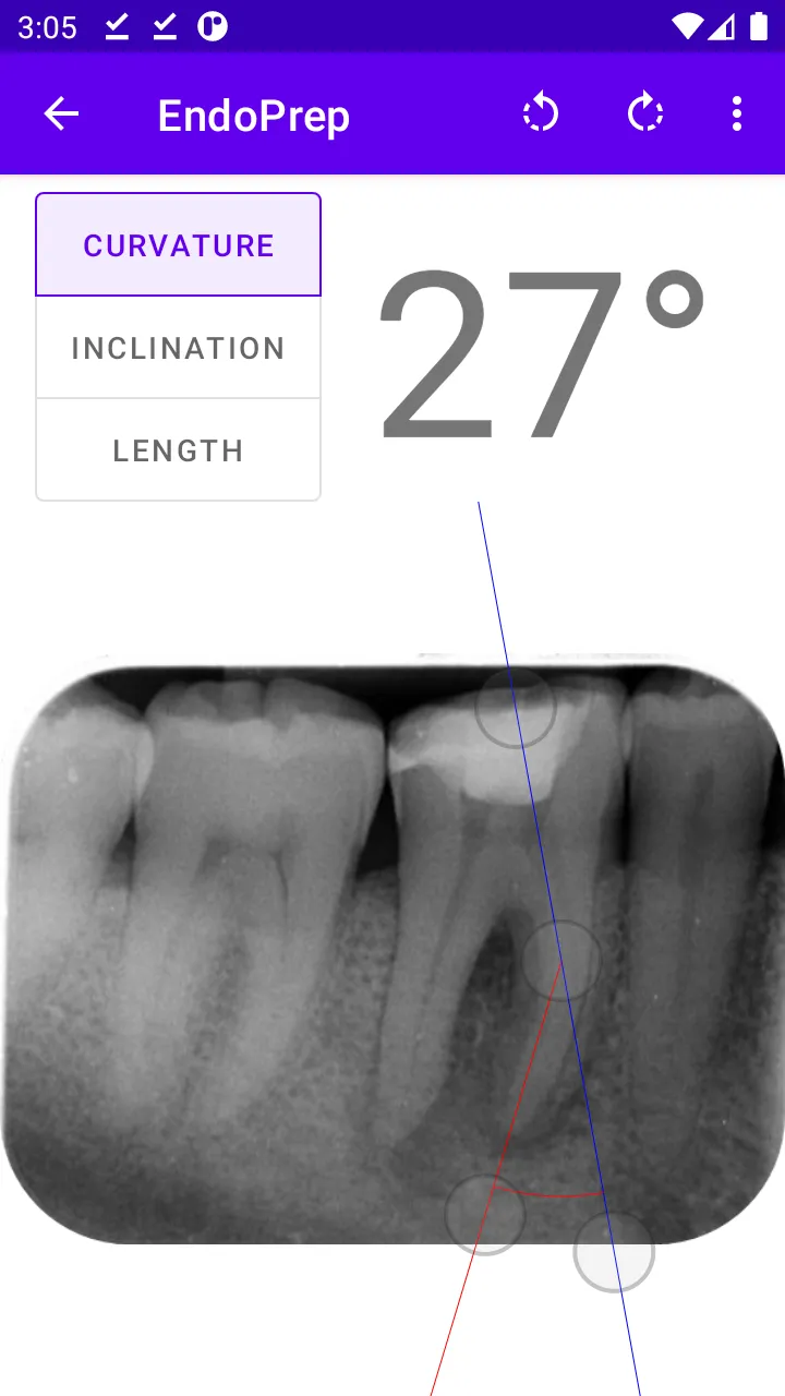 EndoPrep App | Indus Appstore | Screenshot