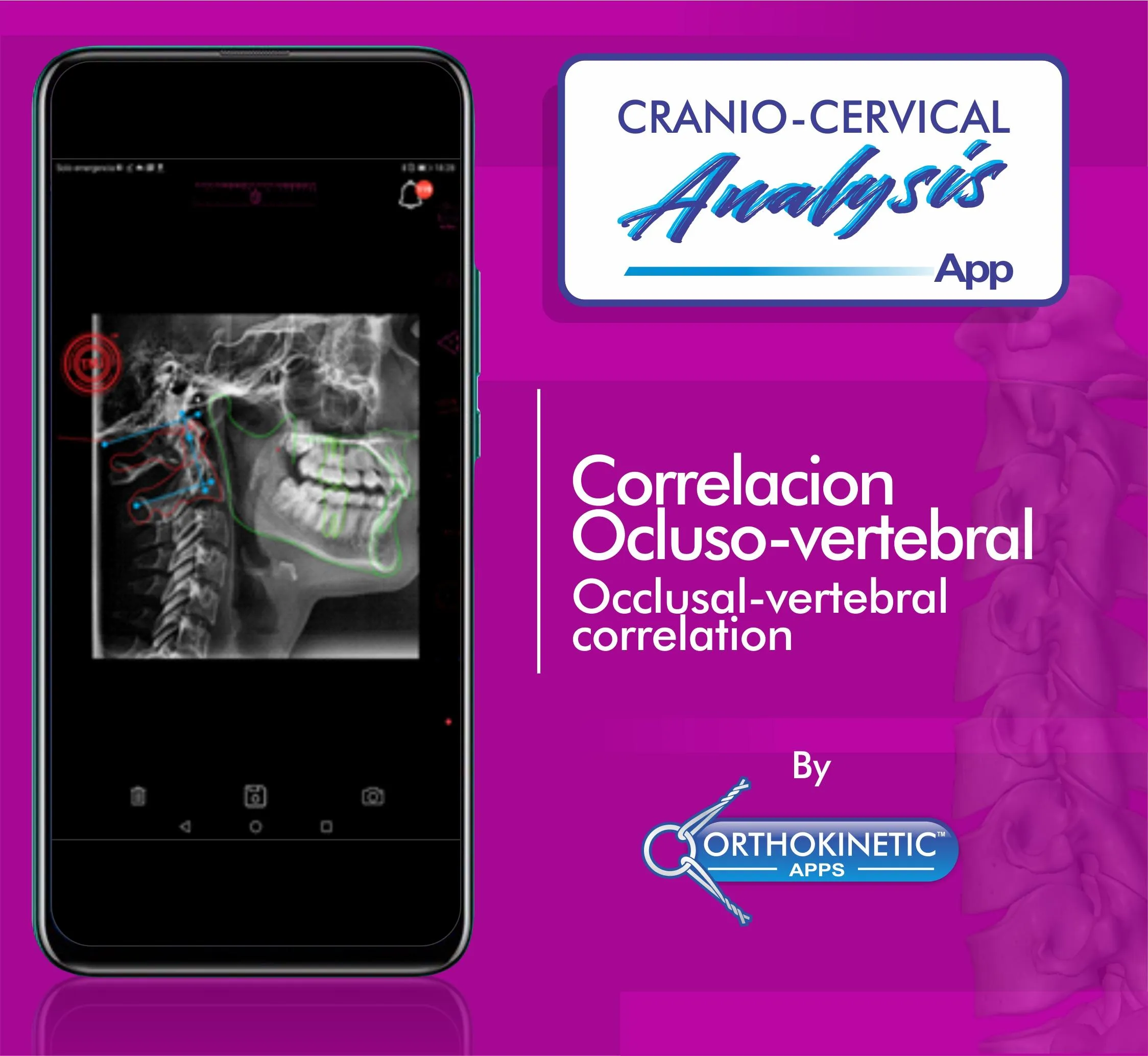 Cranio-cervical Analysis by Or | Indus Appstore | Screenshot