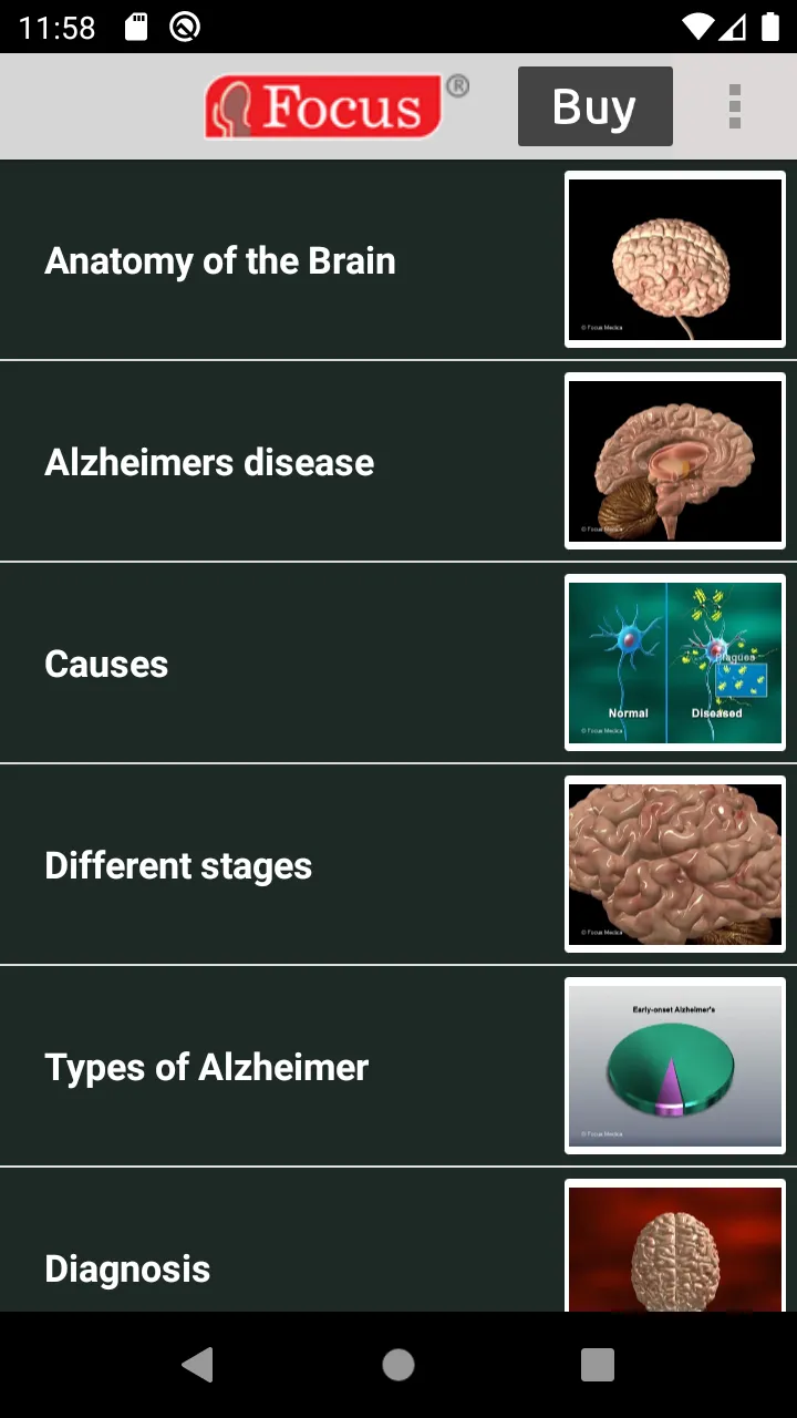 Alzheimer Disease | Indus Appstore | Screenshot