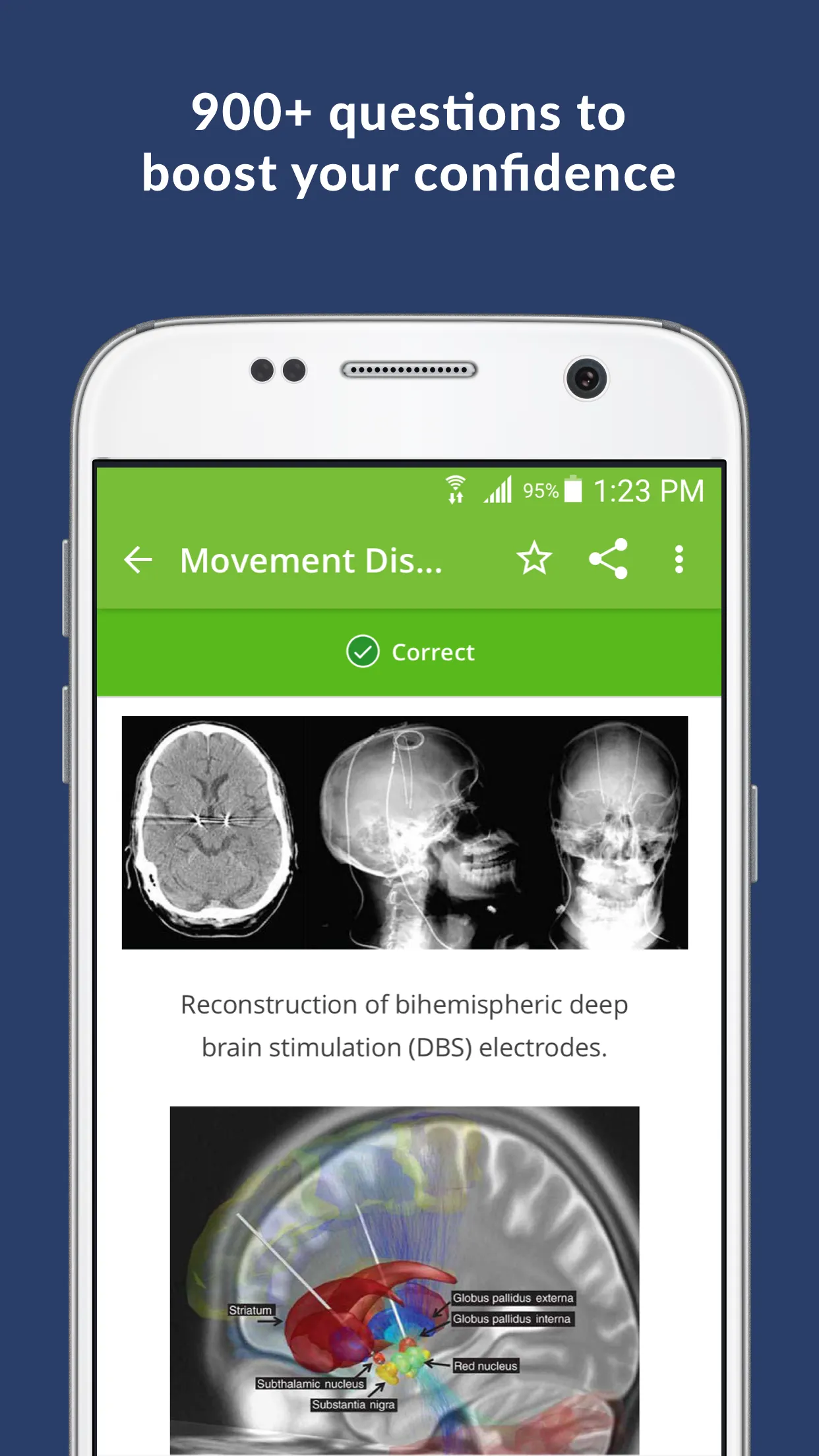 Neurology Exam Review & Practi | Indus Appstore | Screenshot