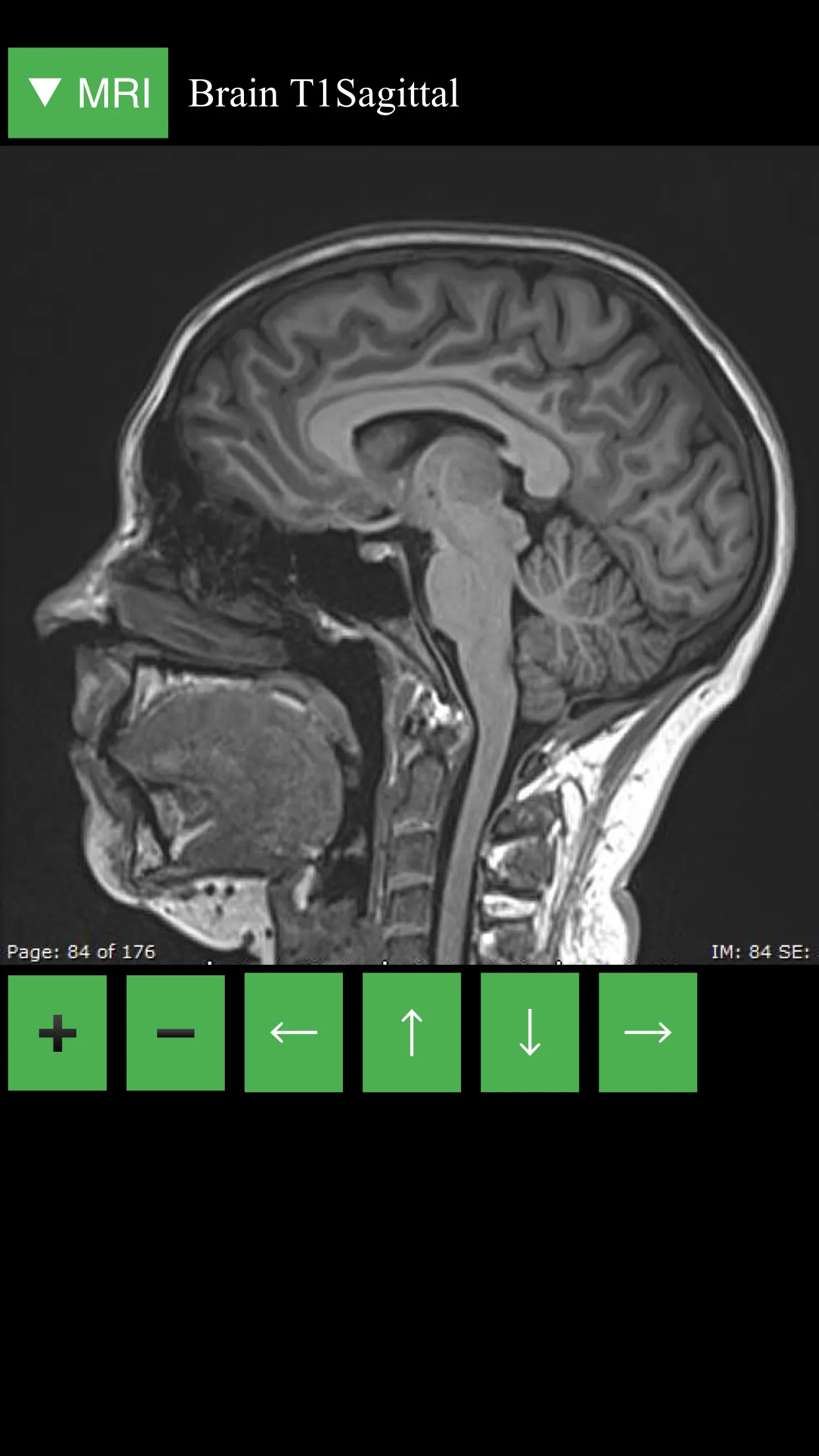 MRI Viewer | Indus Appstore | Screenshot