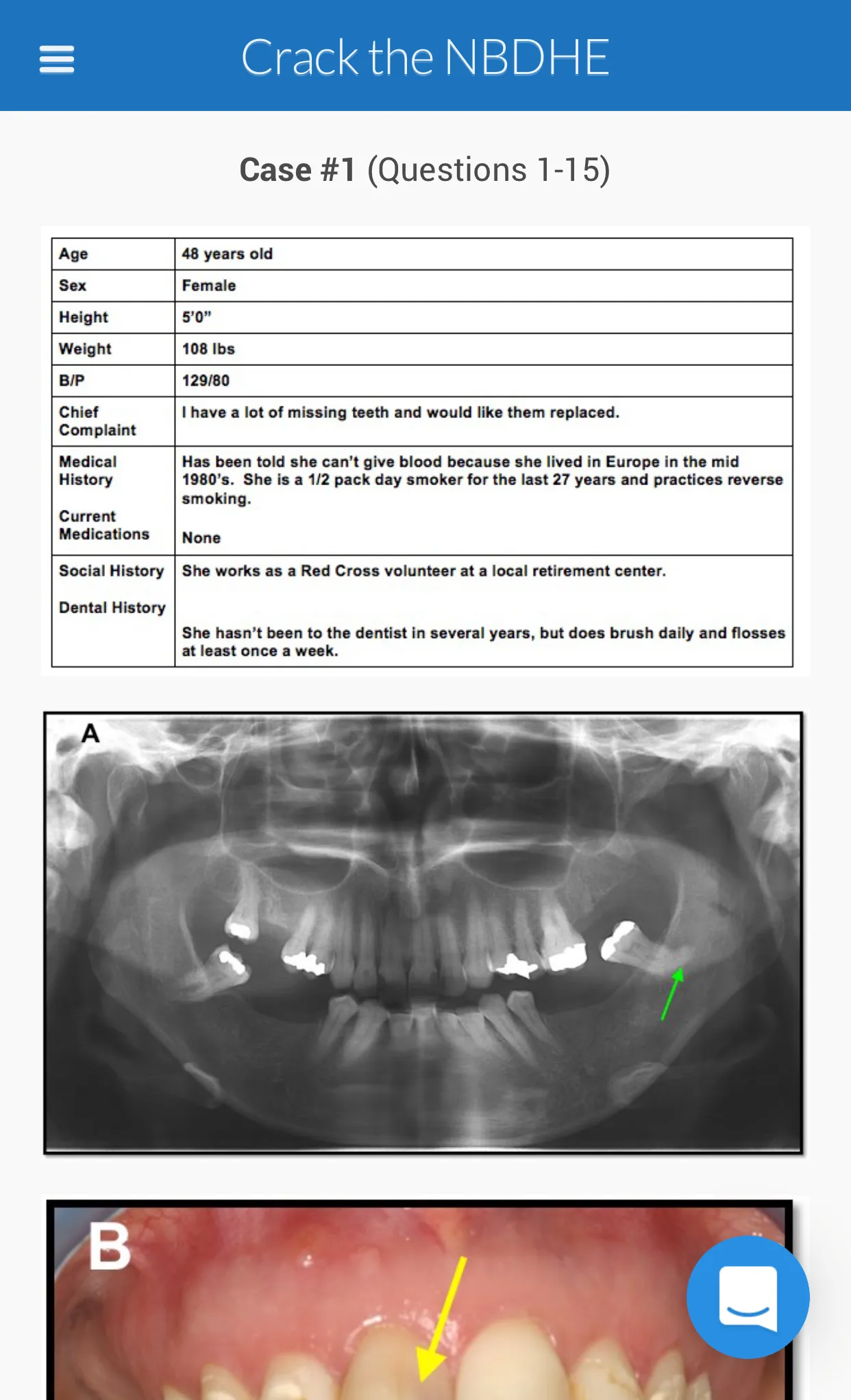 NBDHE - Dental Hygiene Prep | Indus Appstore | Screenshot