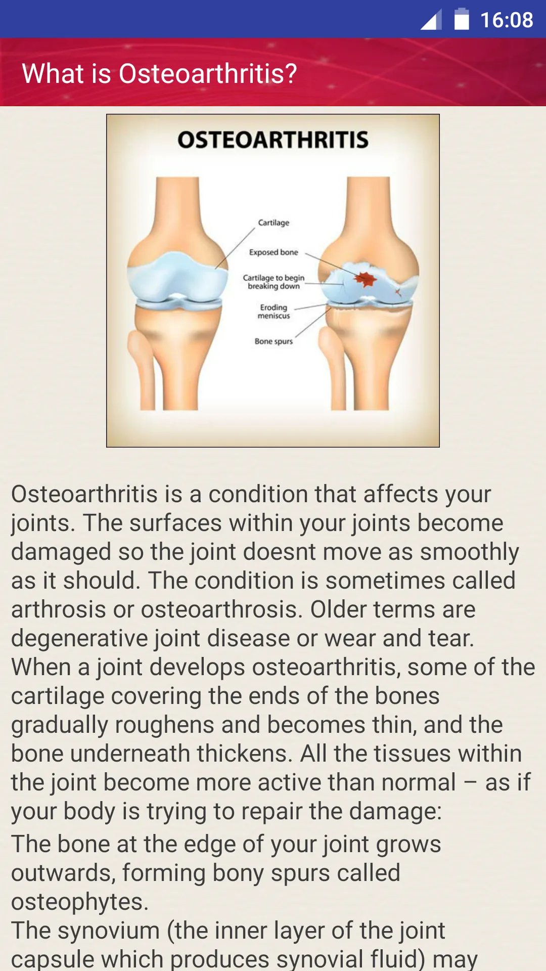 Joint Pain Osteoarthritis Help | Indus Appstore | Screenshot