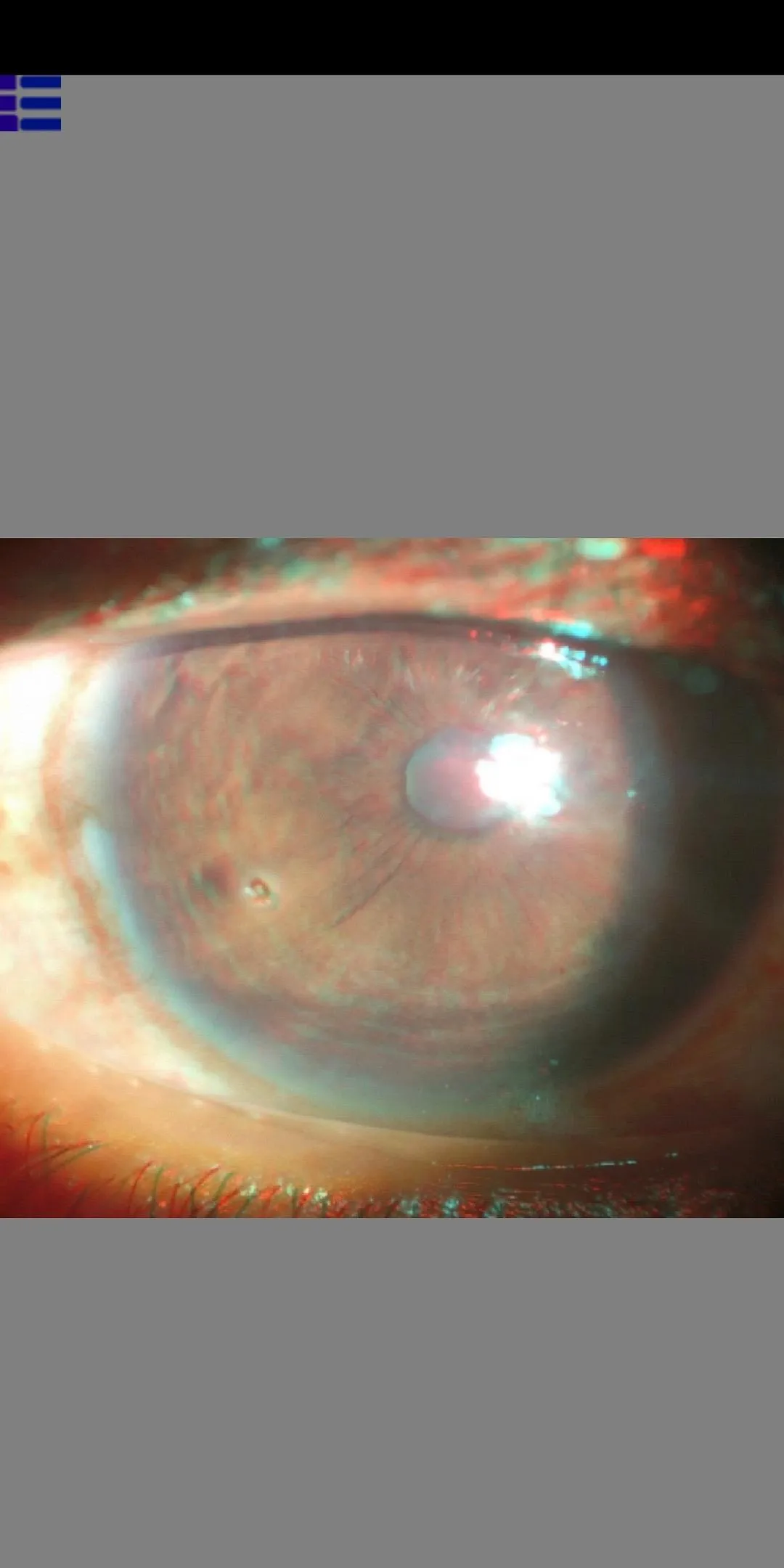 3D Atlas of Ophthalmology | Indus Appstore | Screenshot