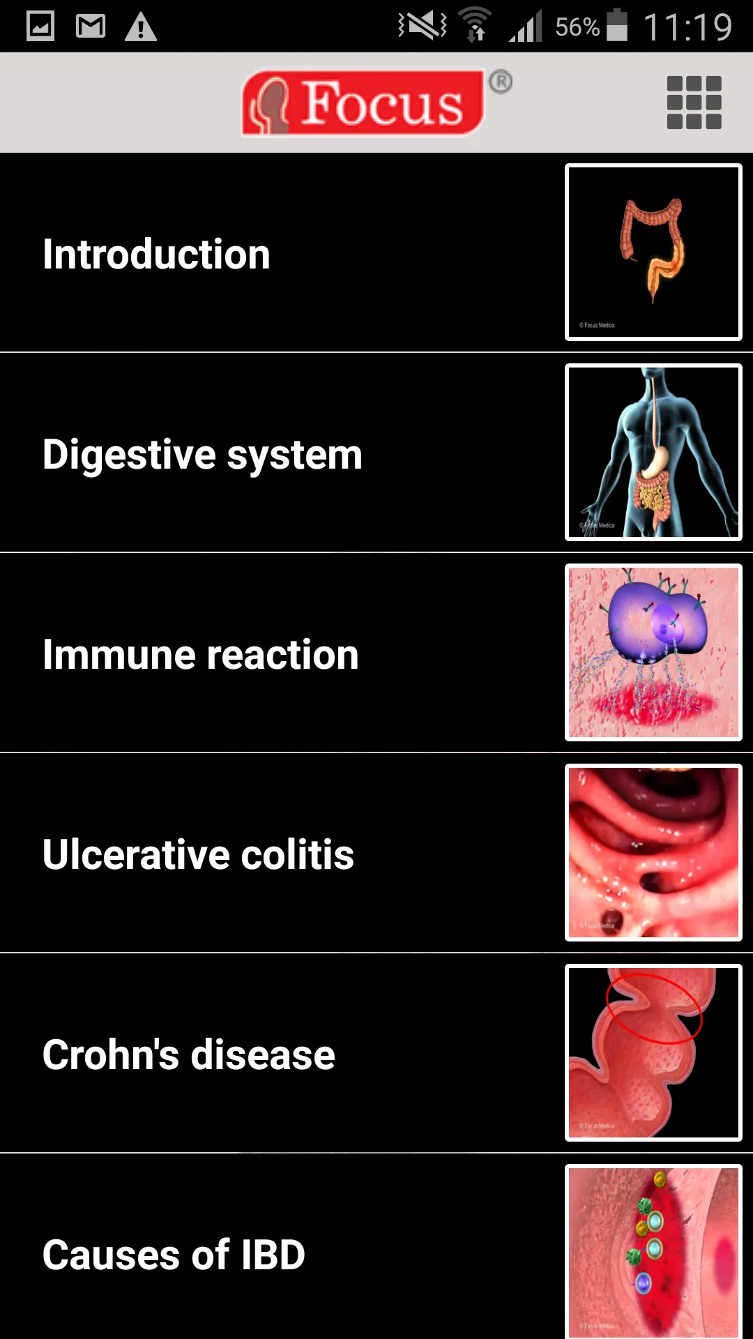 Inflammatory Bowel Disease | Indus Appstore | Screenshot