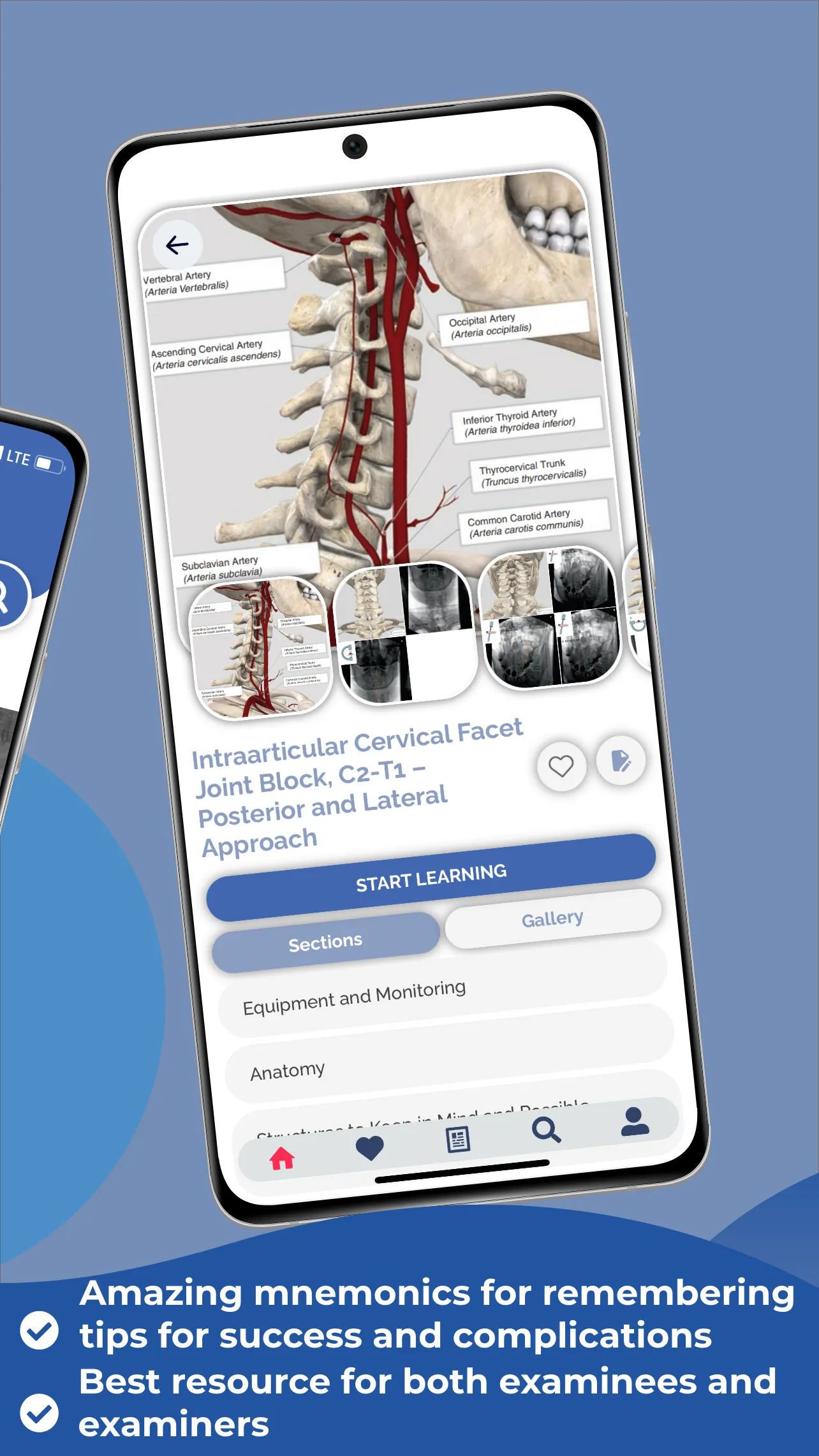 Interventional Pain App | Indus Appstore | Screenshot