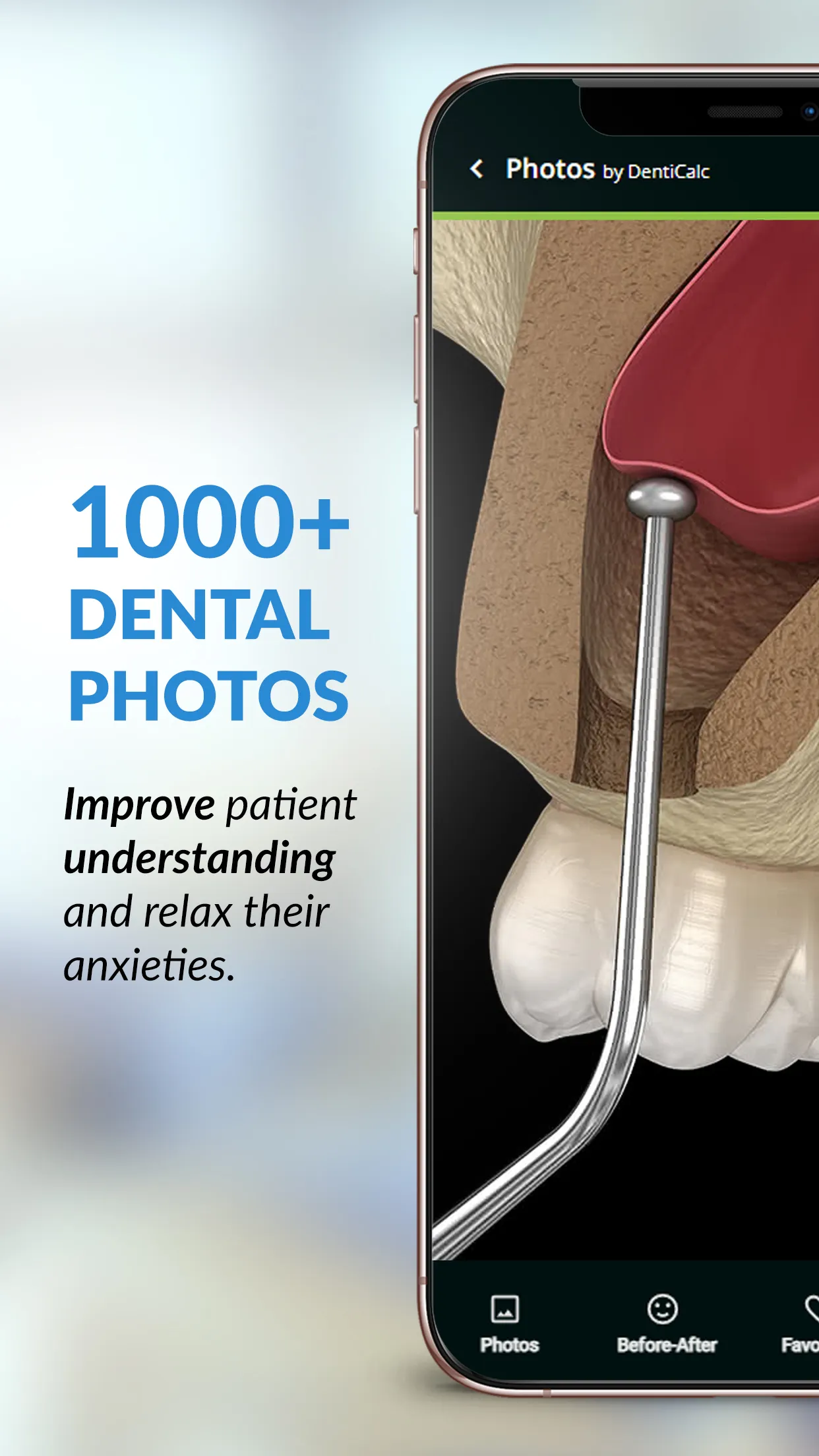 DentiCalc: the dental app | Indus Appstore | Screenshot