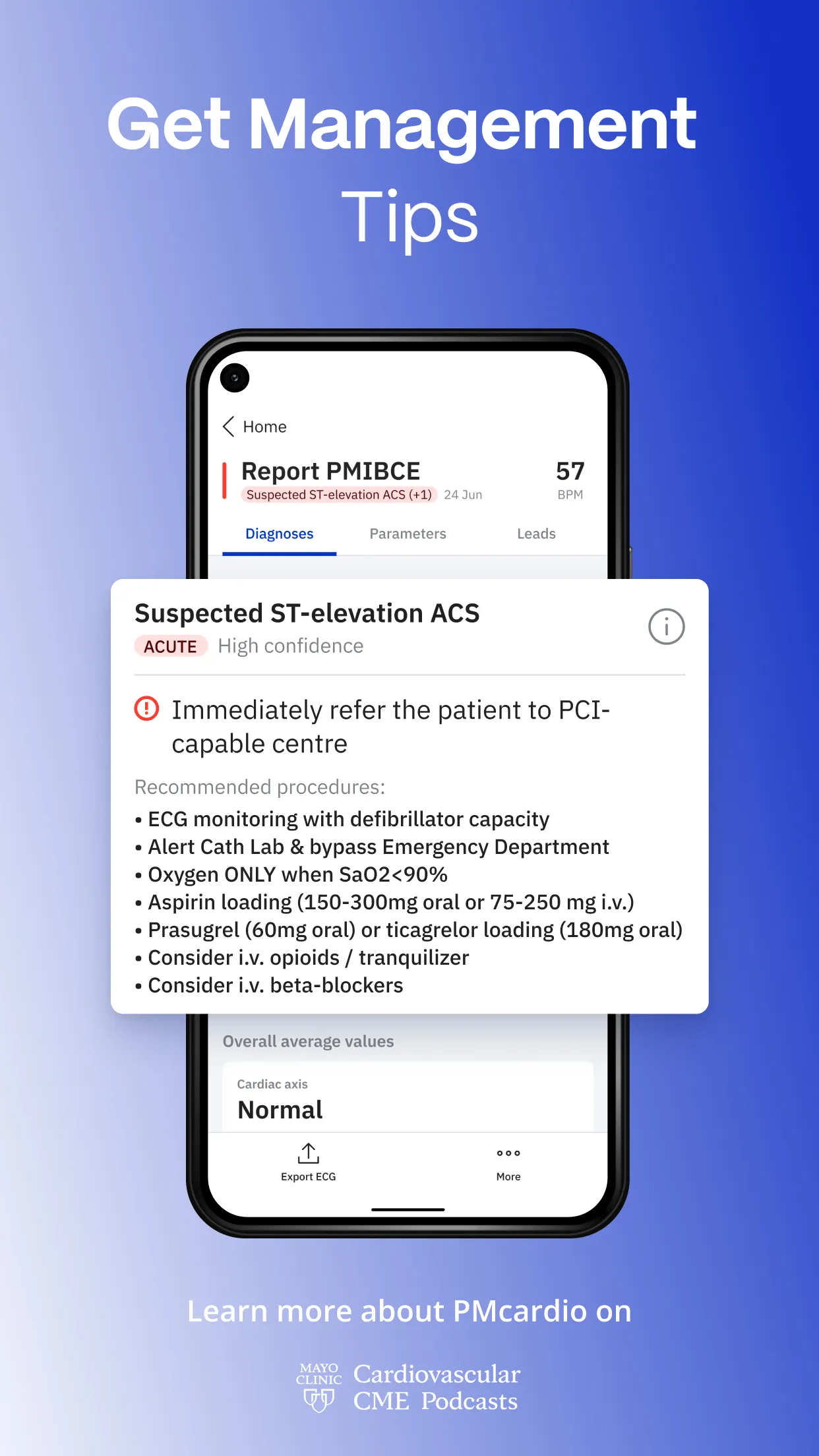 PMcardio - ECG Analysis | Indus Appstore | Screenshot