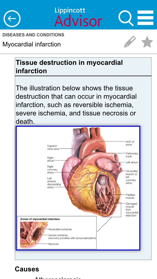 Lippincott Nursing Advisor | Indus Appstore | Screenshot