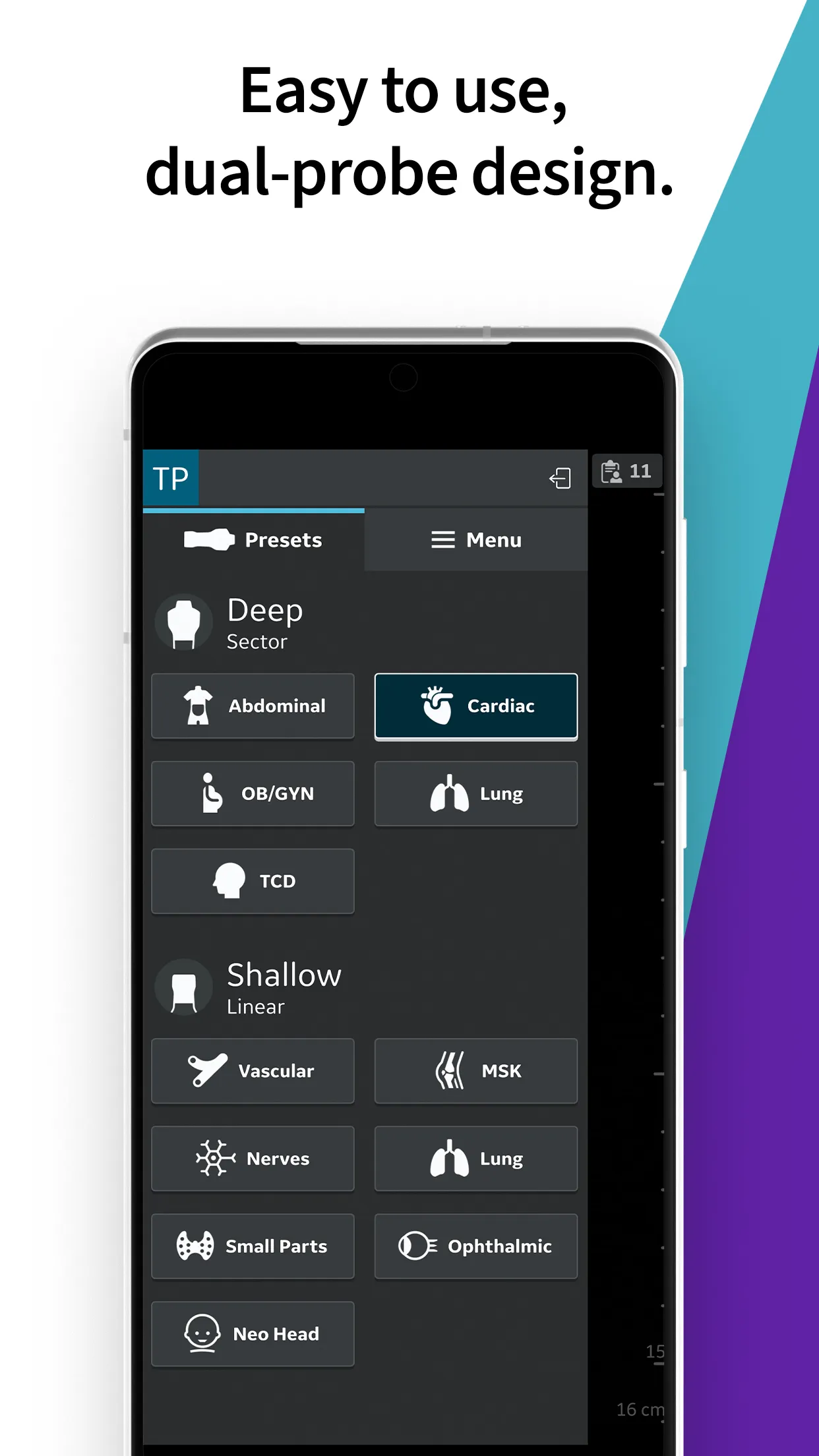 Vscan Air Wireless Ultrasound | Indus Appstore | Screenshot