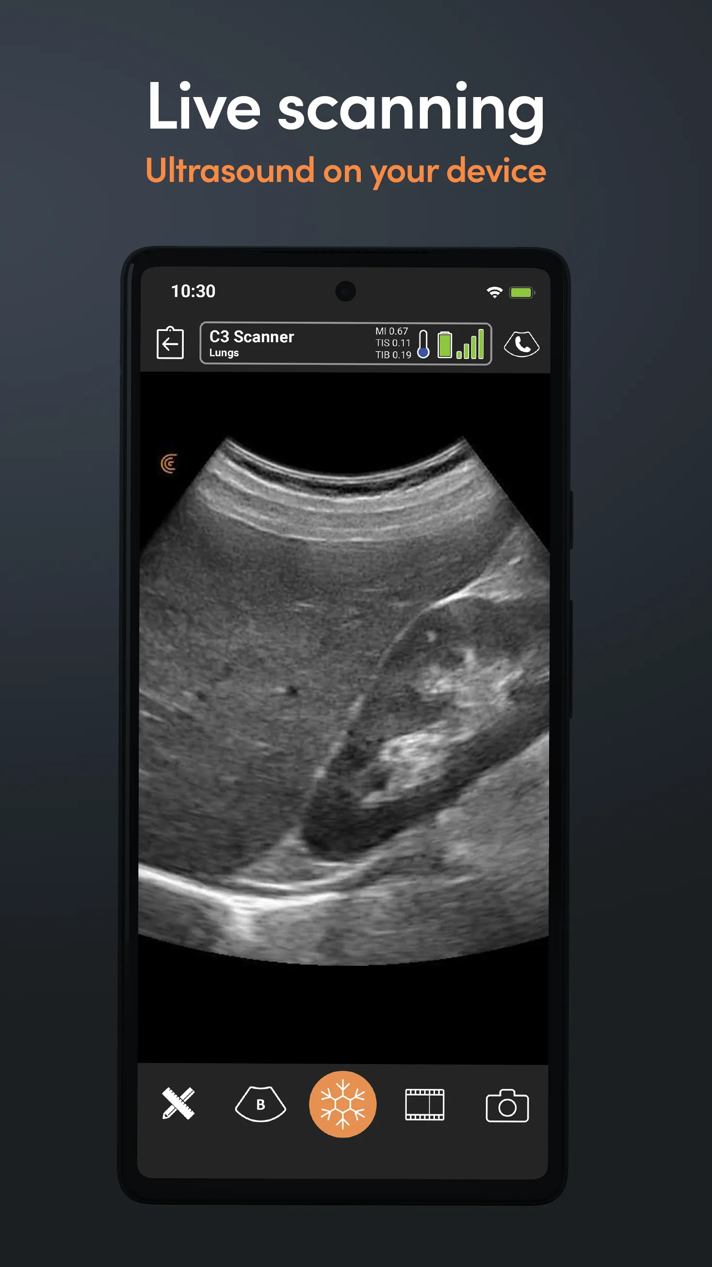 Clarius Ultrasound | Indus Appstore | Screenshot