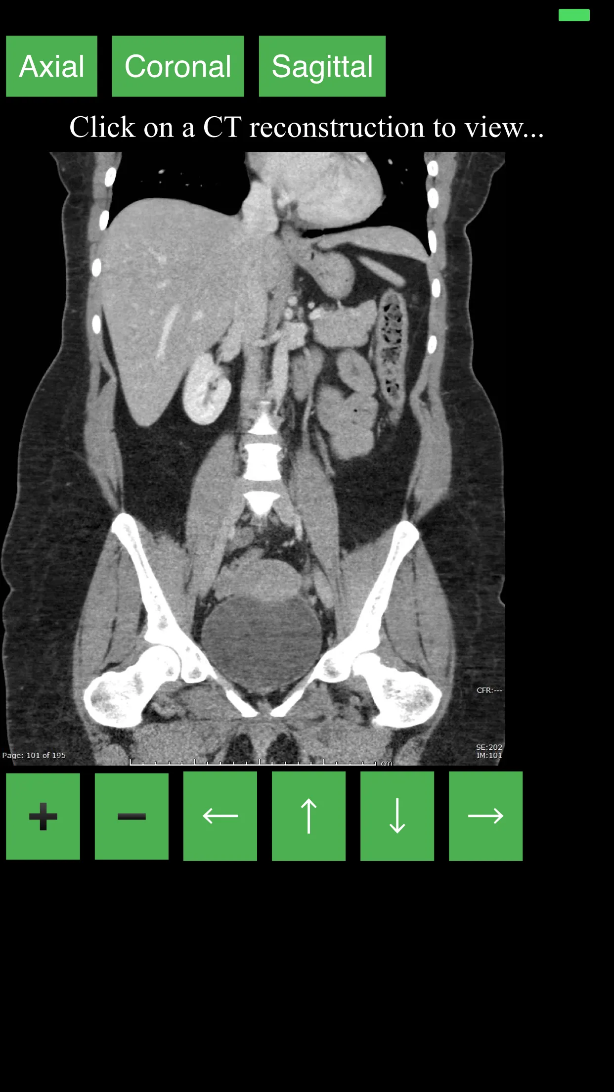 CT Abdomen Pelvis | Indus Appstore | Screenshot