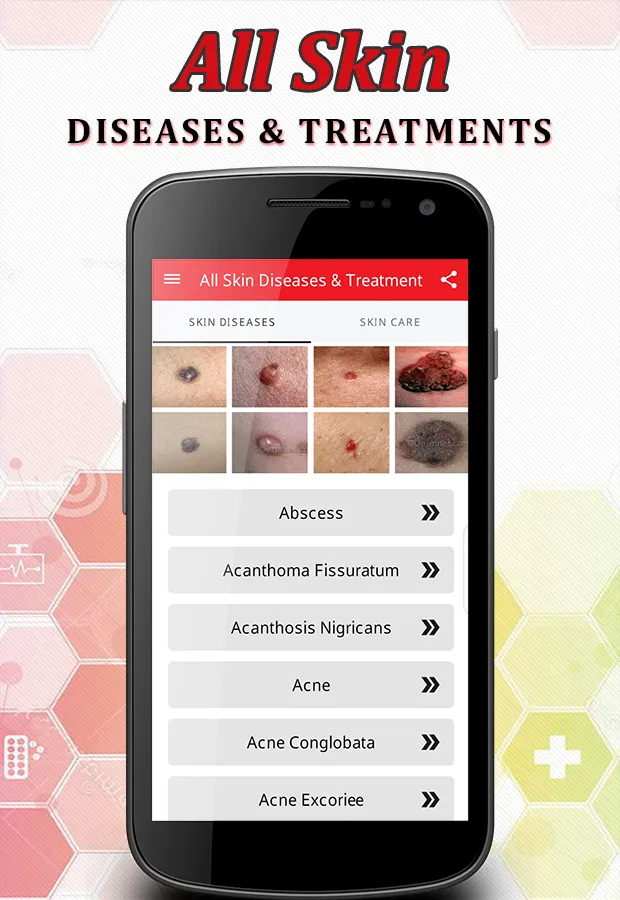 All Skin Diseases & Treatment | Indus Appstore | Screenshot