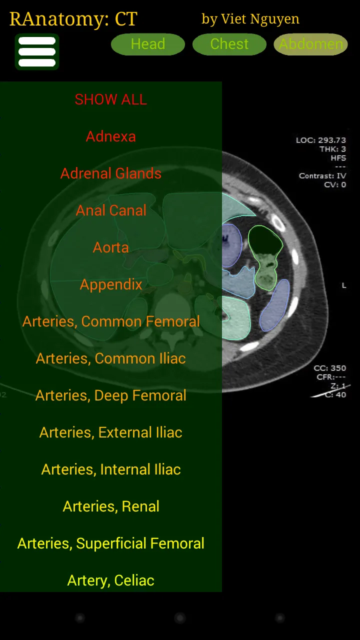 Radiology CT Anatomy | Indus Appstore | Screenshot