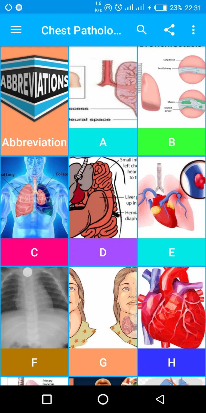 A-Z Chest XRay Pathology Guide | Indus Appstore | Screenshot