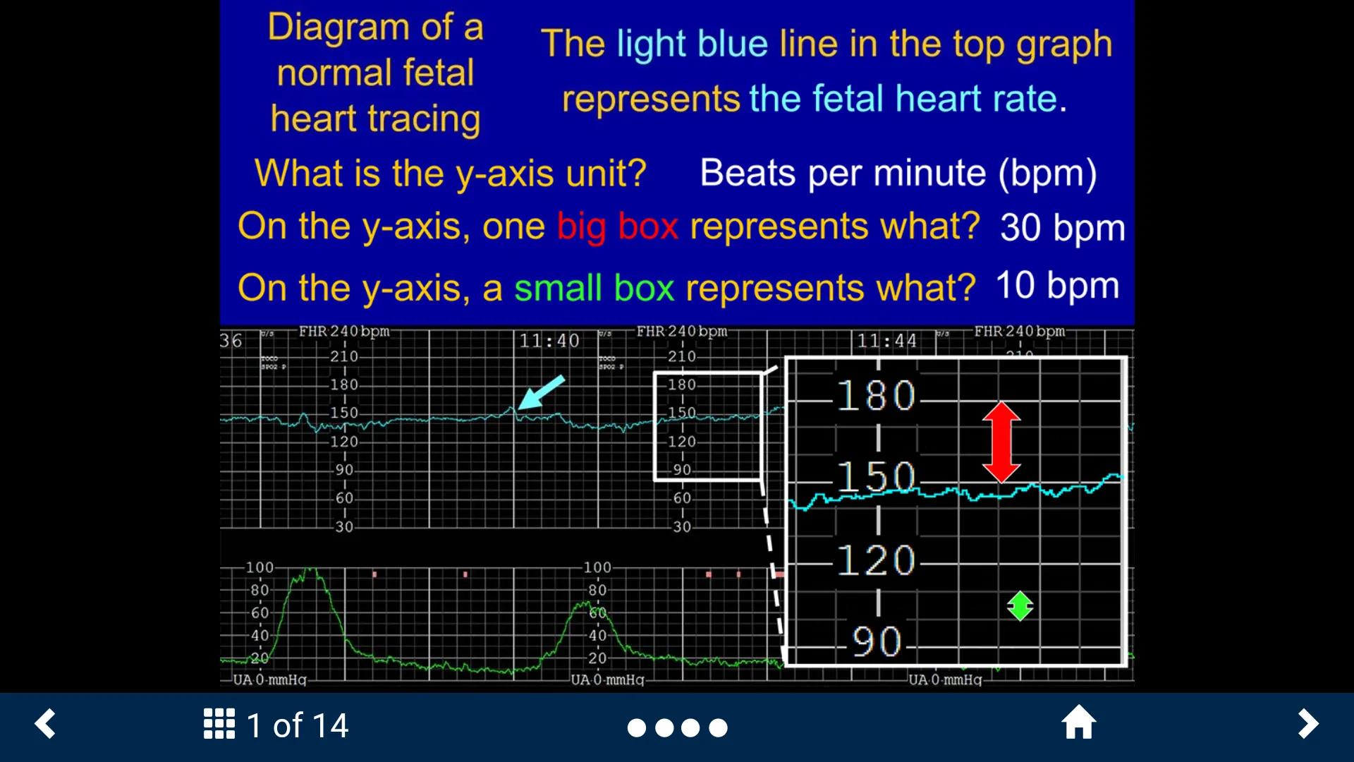 Fetal Heart Rate - SecondLook | Indus Appstore | Screenshot