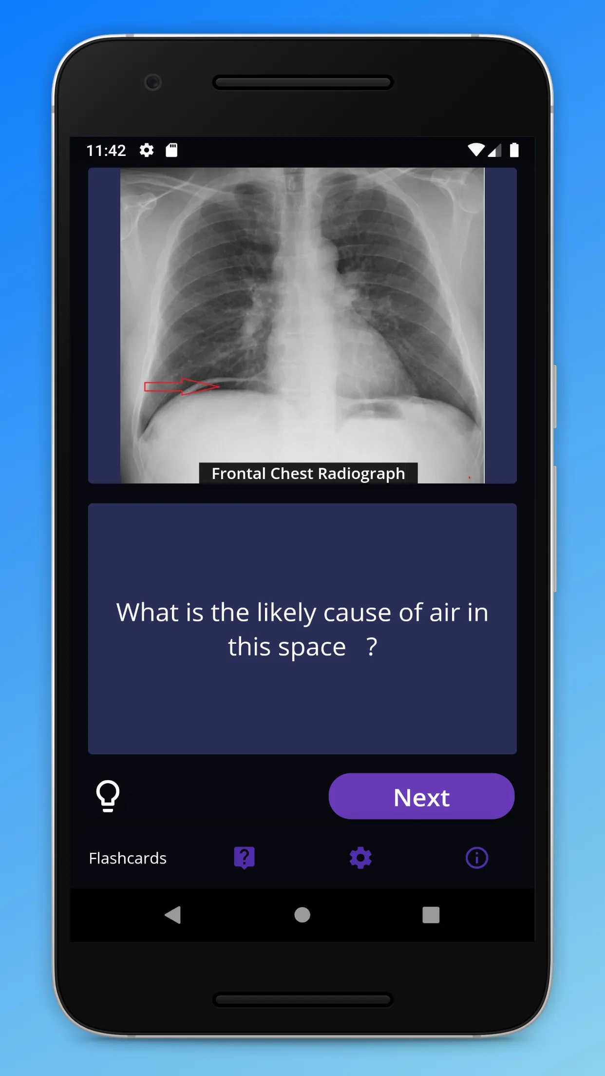 Basic Radiology | Indus Appstore | Screenshot