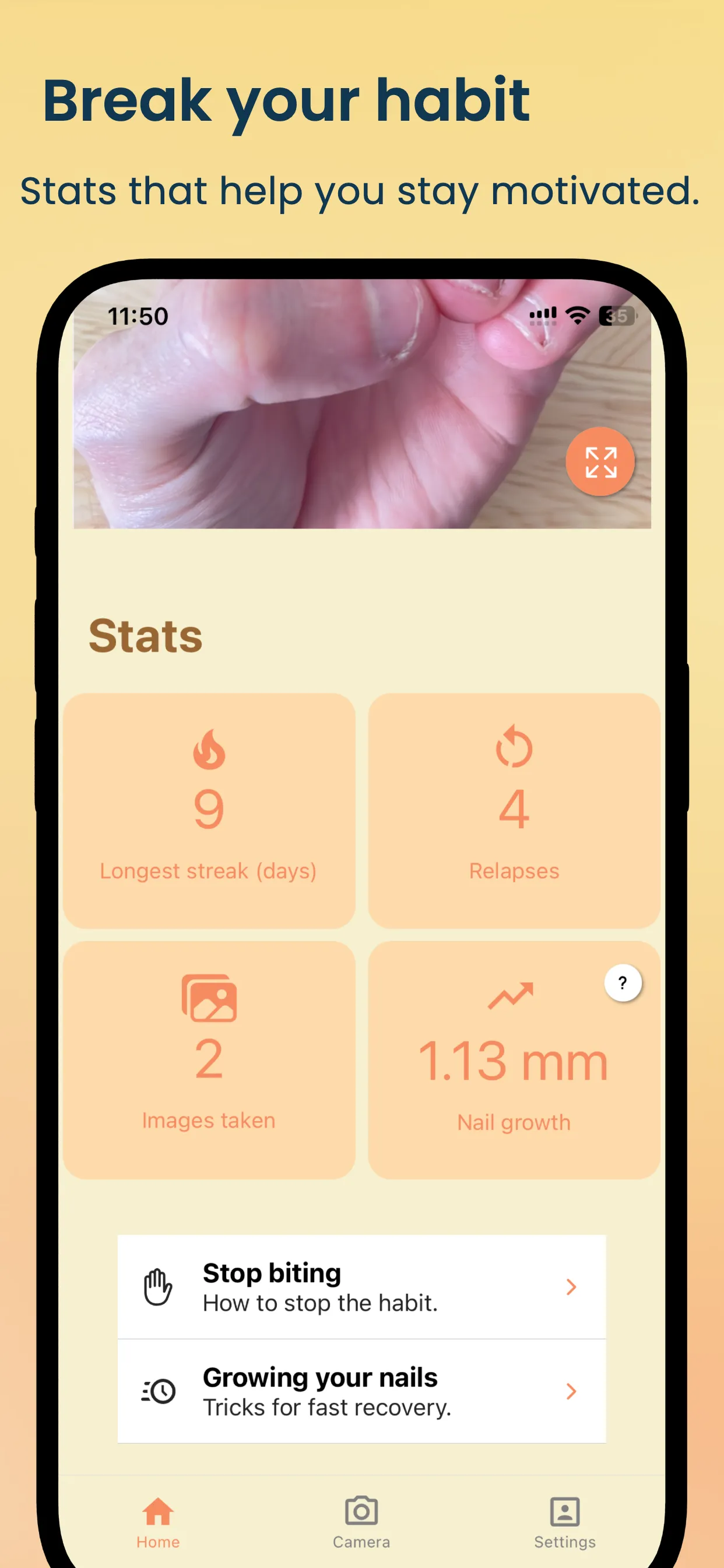 NailKeeper - Stop Biting Nails | Indus Appstore | Screenshot