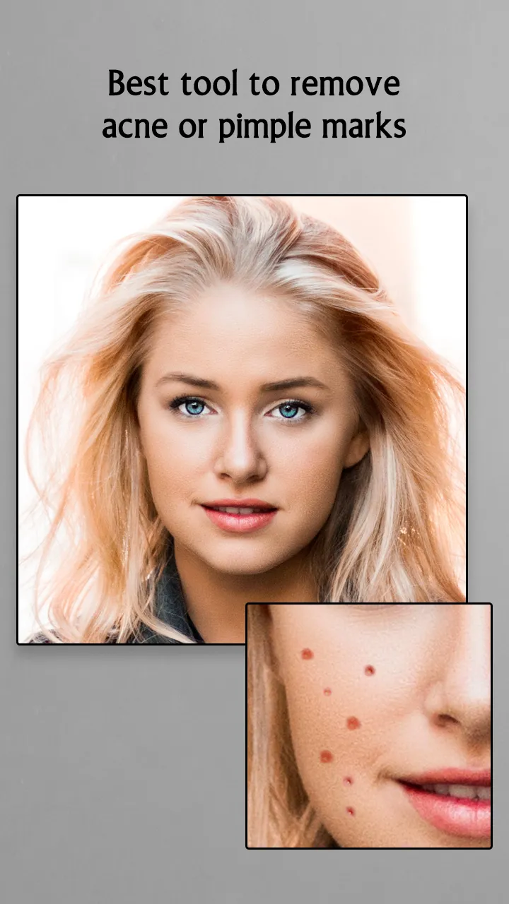 Remove Acne from Face | Indus Appstore | Screenshot