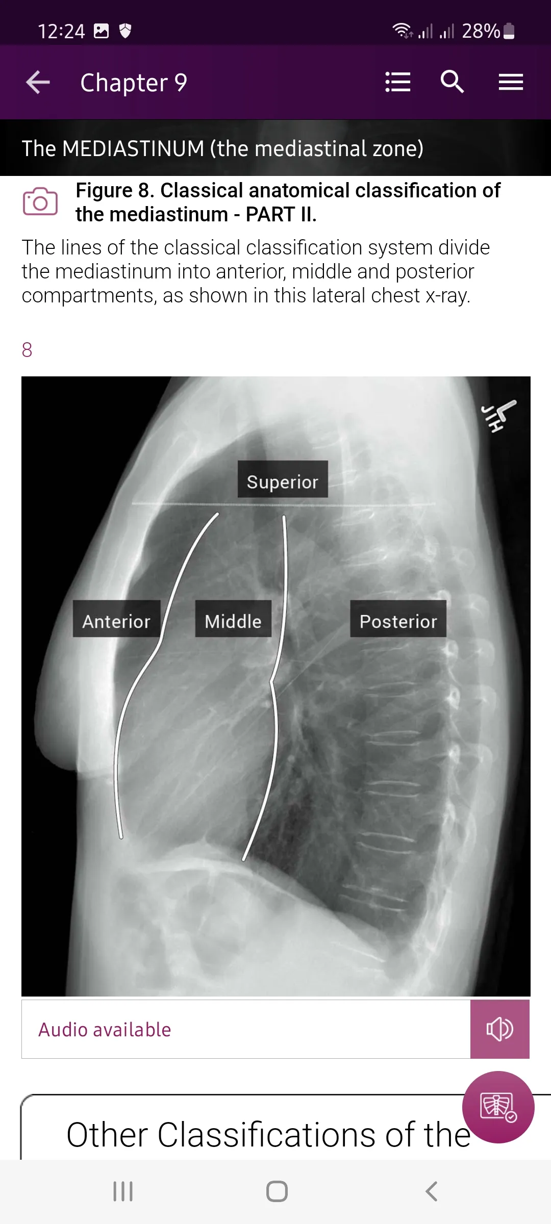 Chest X-Ray DEMO | Indus Appstore | Screenshot