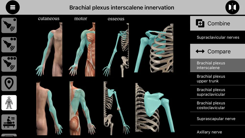 AnSo Anaesthesia Sonoanatomy | Indus Appstore | Screenshot
