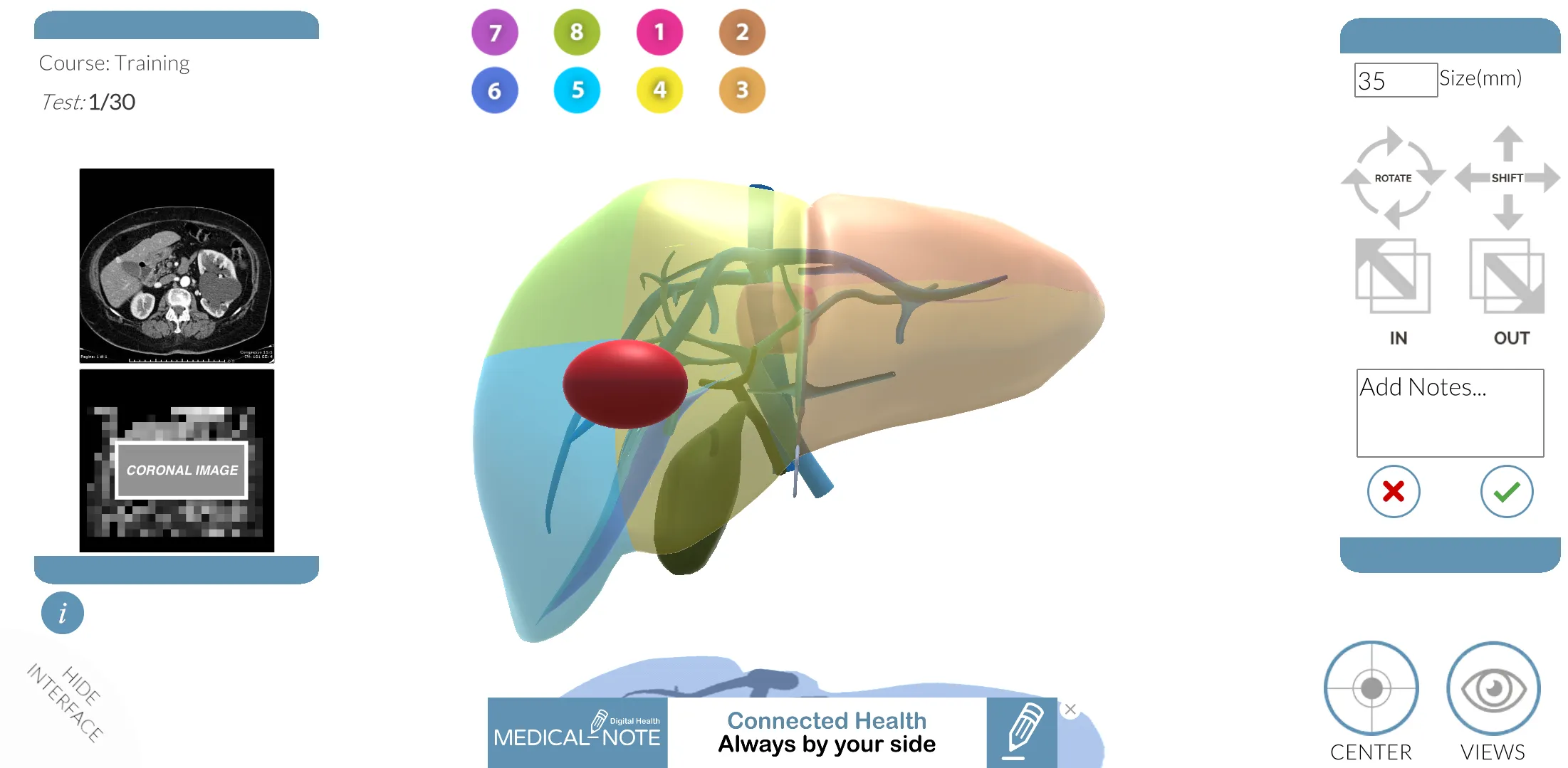 LIVER-NOTE.Edu | Indus Appstore | Screenshot