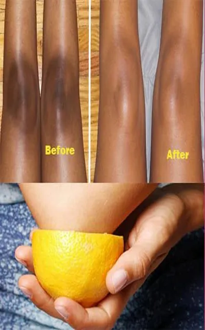 How to Get Rid Of Dark Knees A | Indus Appstore | Screenshot