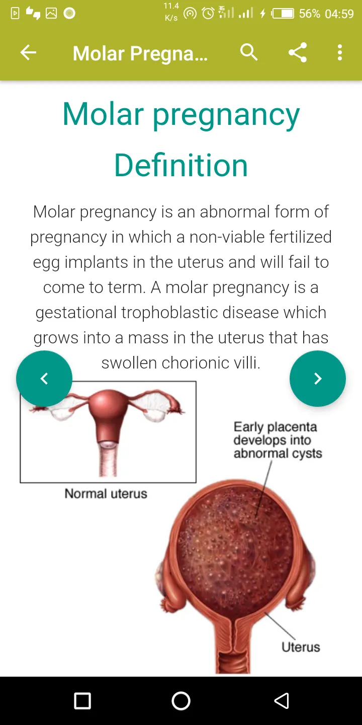 AZ Gynecology Ultrasound Guide | Indus Appstore | Screenshot