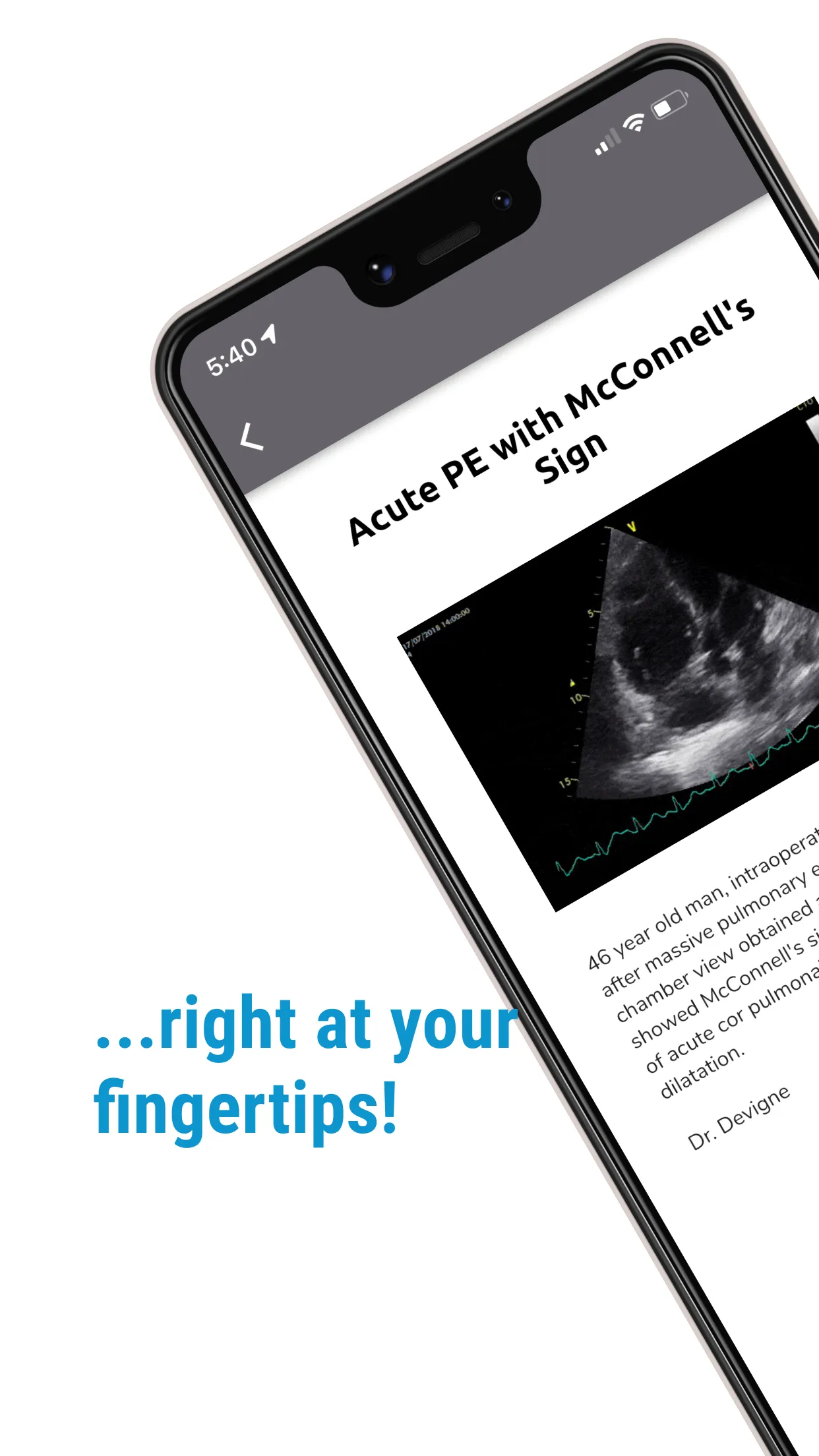 The POCUS Atlas | Indus Appstore | Screenshot