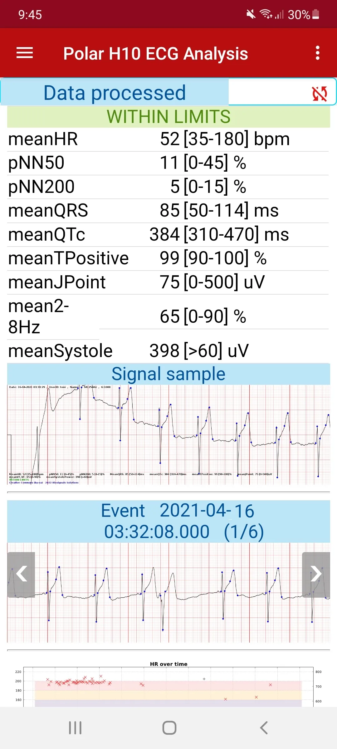 ECG Analysis for Polar H10 | Indus Appstore | Screenshot