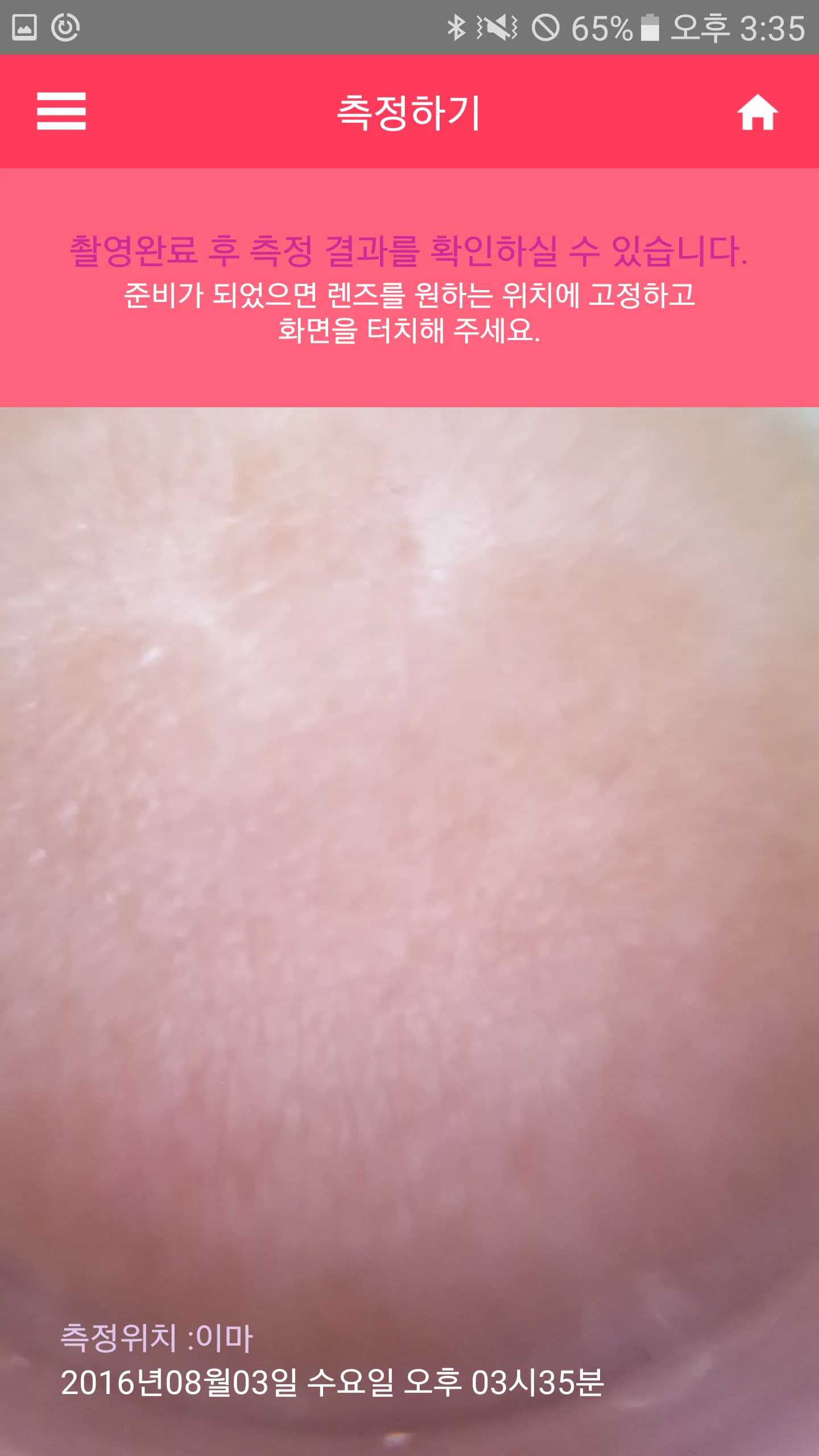 힐스킨 체커 Healskin Checker | Indus Appstore | Screenshot