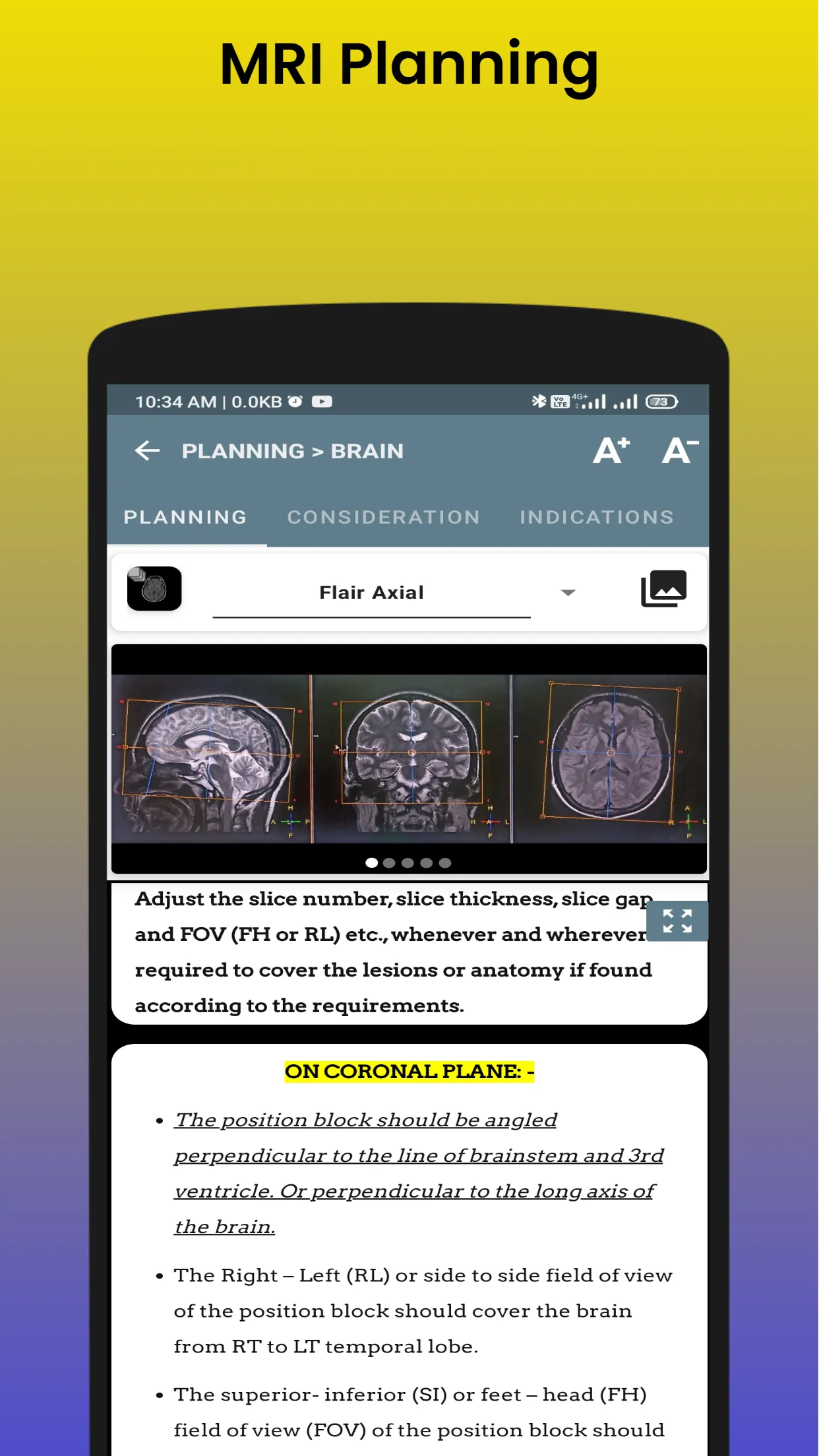 Master in MRI | MRI Scan | Indus Appstore | Screenshot