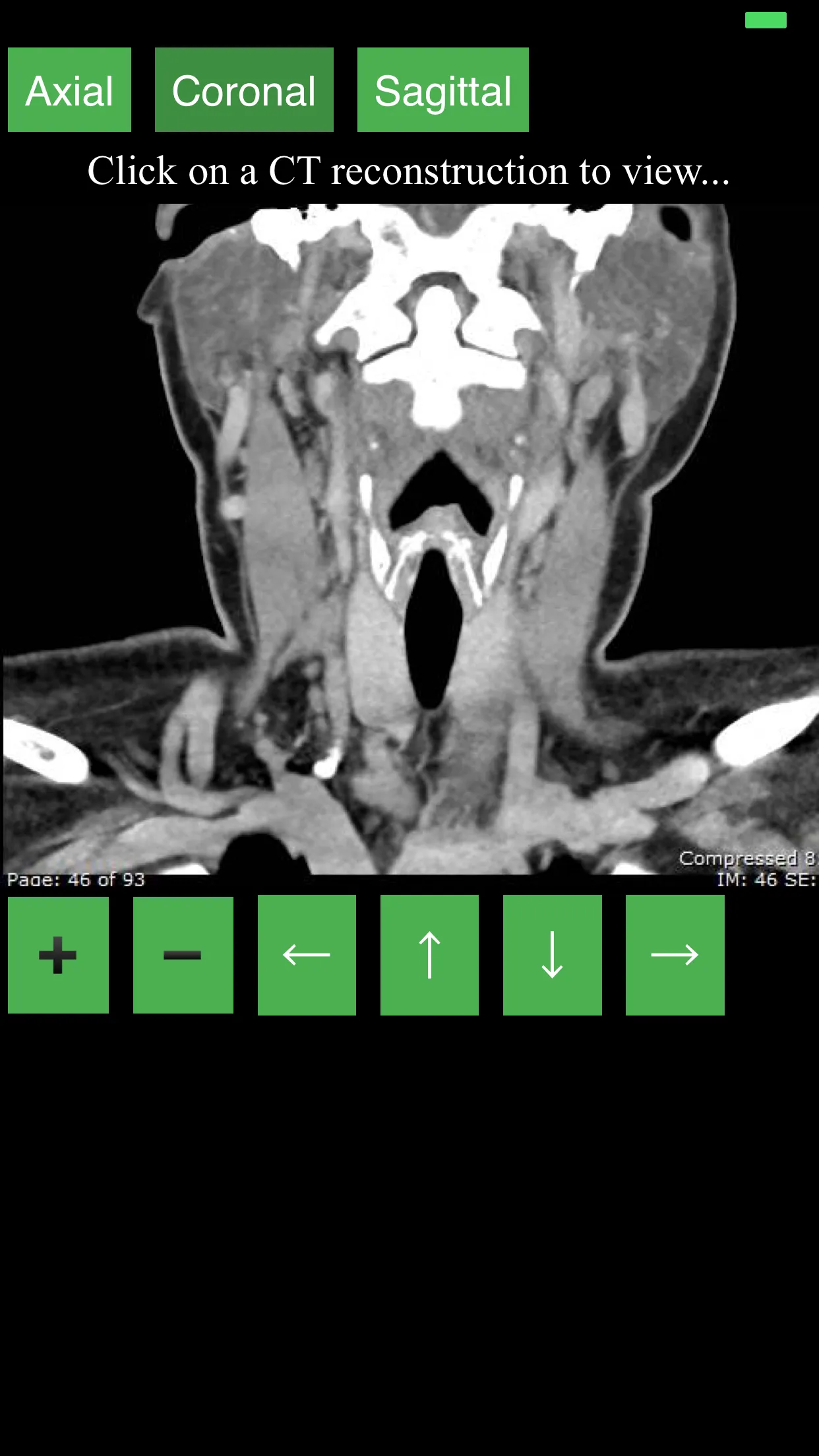 CT Neck | Indus Appstore | Screenshot