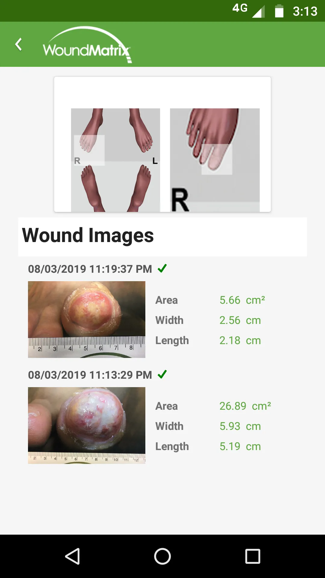 WoundMatrix Patient | Indus Appstore | Screenshot