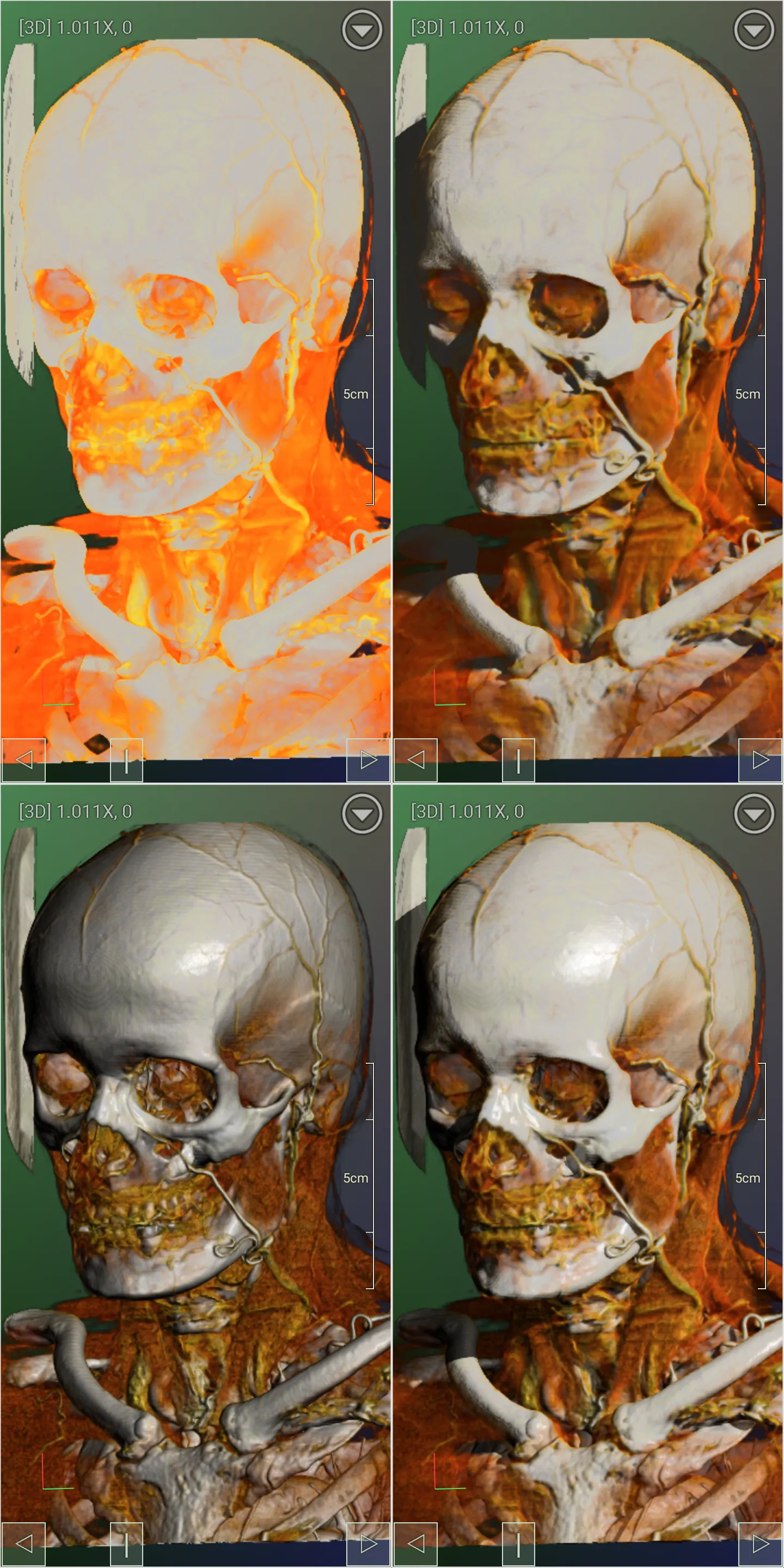 DroidRender - 3D DICOM viewer | Indus Appstore | Screenshot