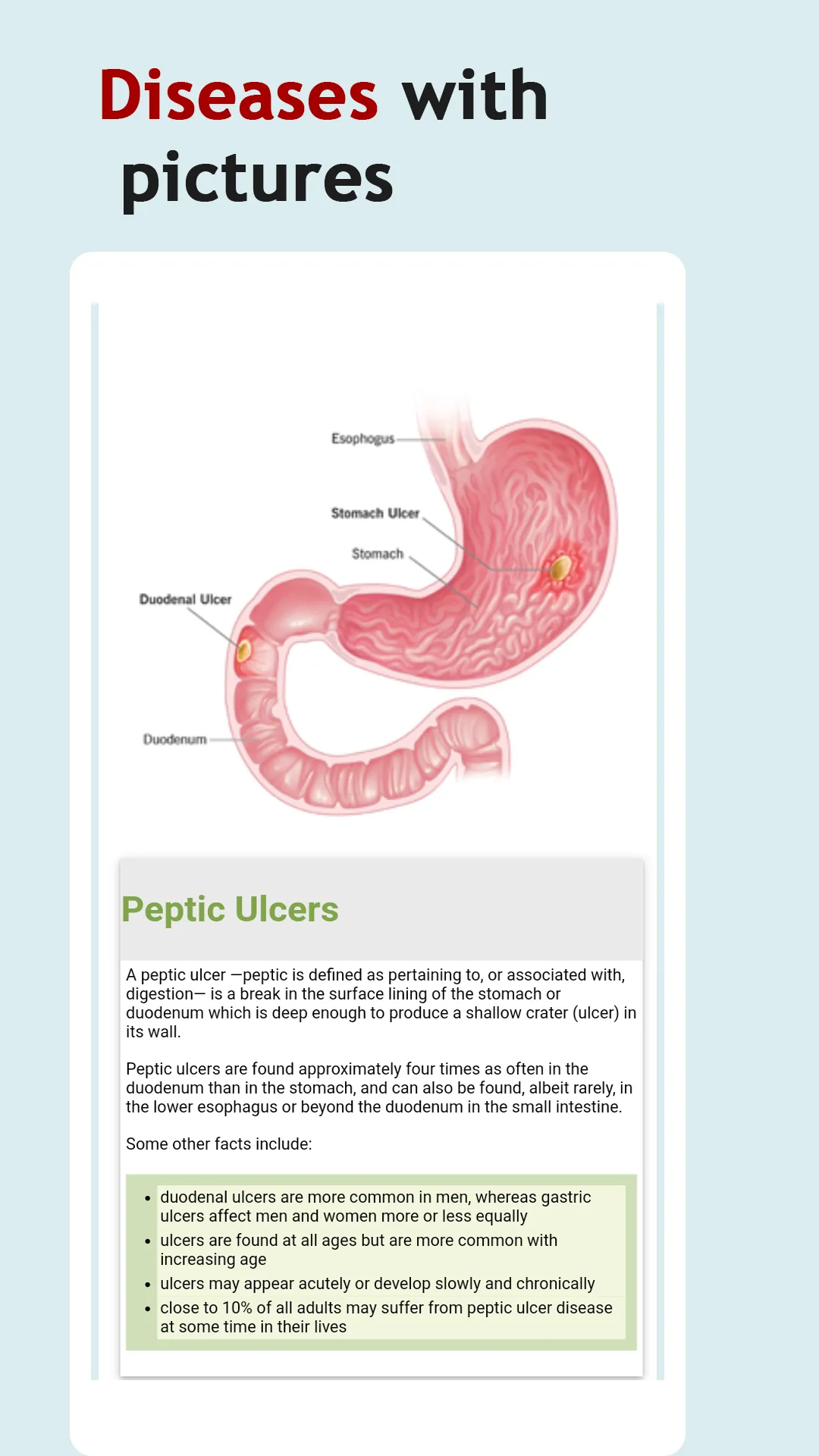 All Stomach Disease &Treatment | Indus Appstore | Screenshot