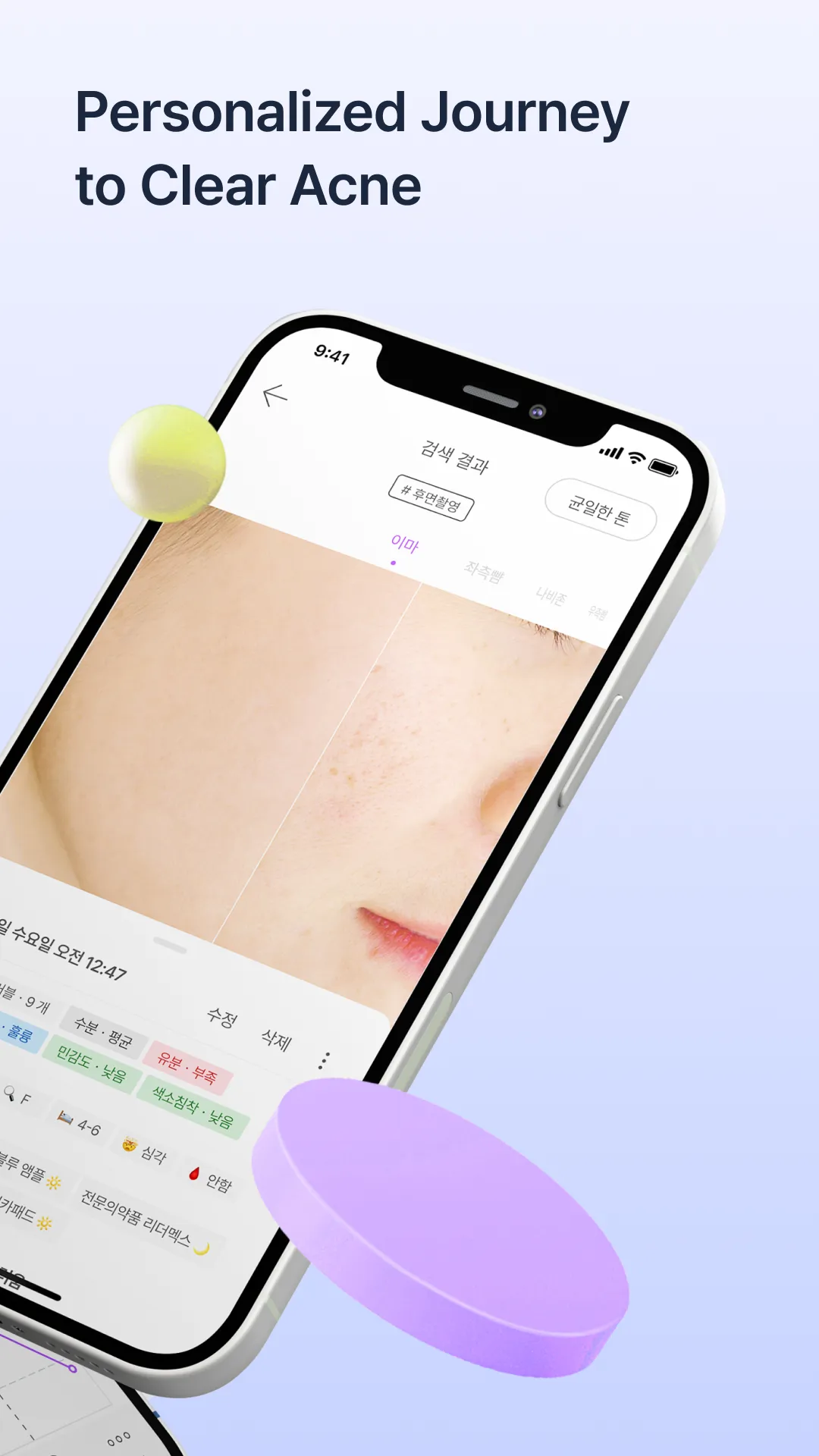 SkinLog | Acne diary | Indus Appstore | Screenshot