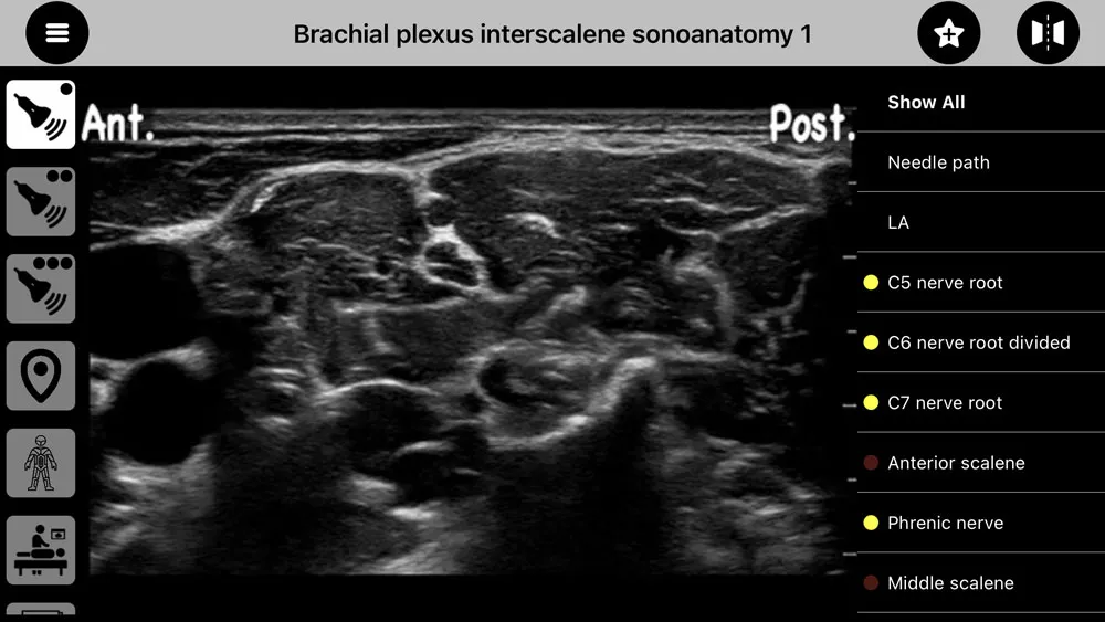 AnSo Anaesthesia Sonoanatomy | Indus Appstore | Screenshot