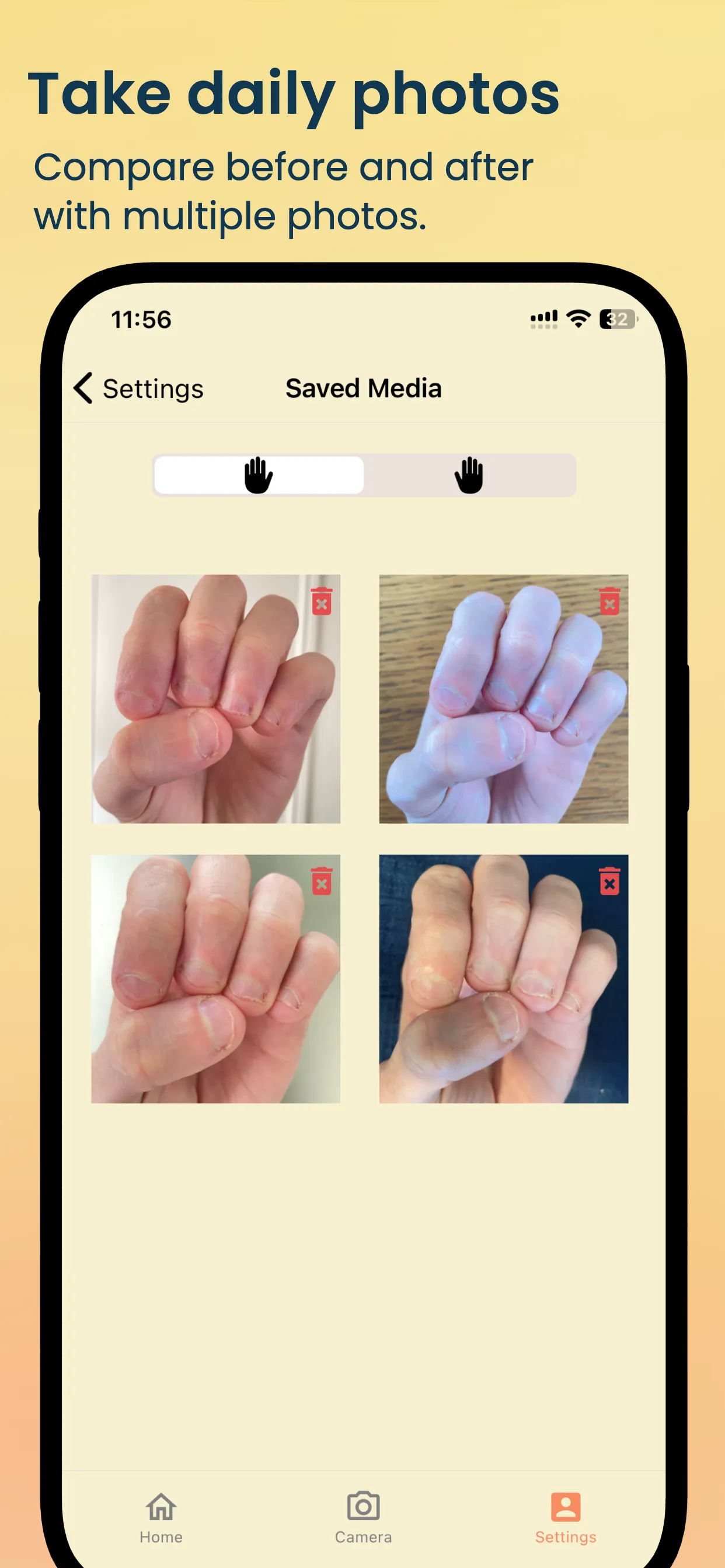 NailKeeper - Stop Biting Nails | Indus Appstore | Screenshot