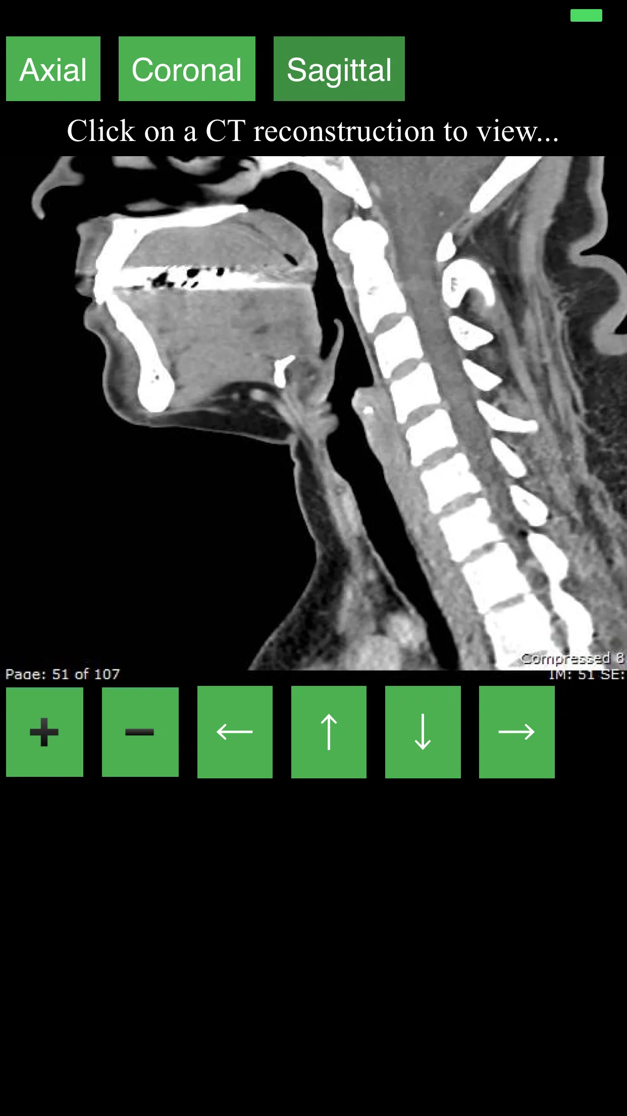 CT Neck | Indus Appstore | Screenshot