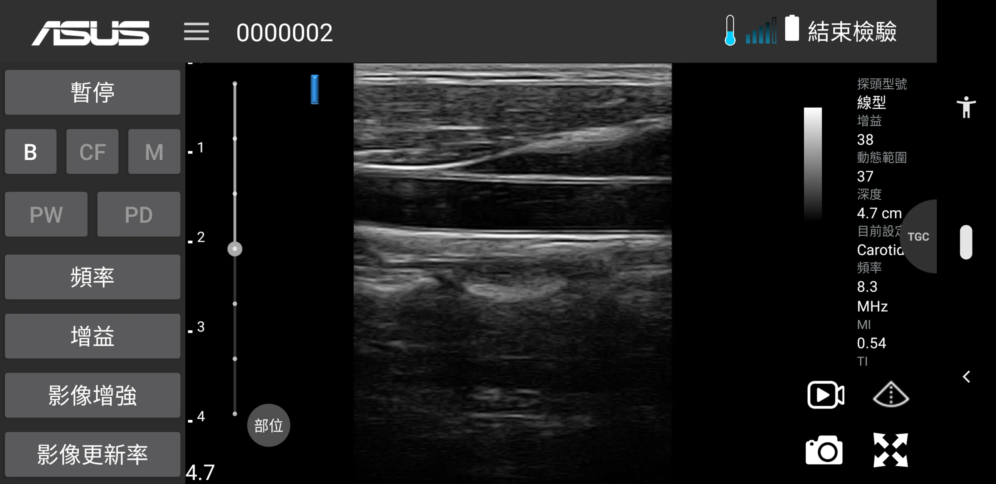 MediConnect – ASUS Ultrasound | Indus Appstore | Screenshot