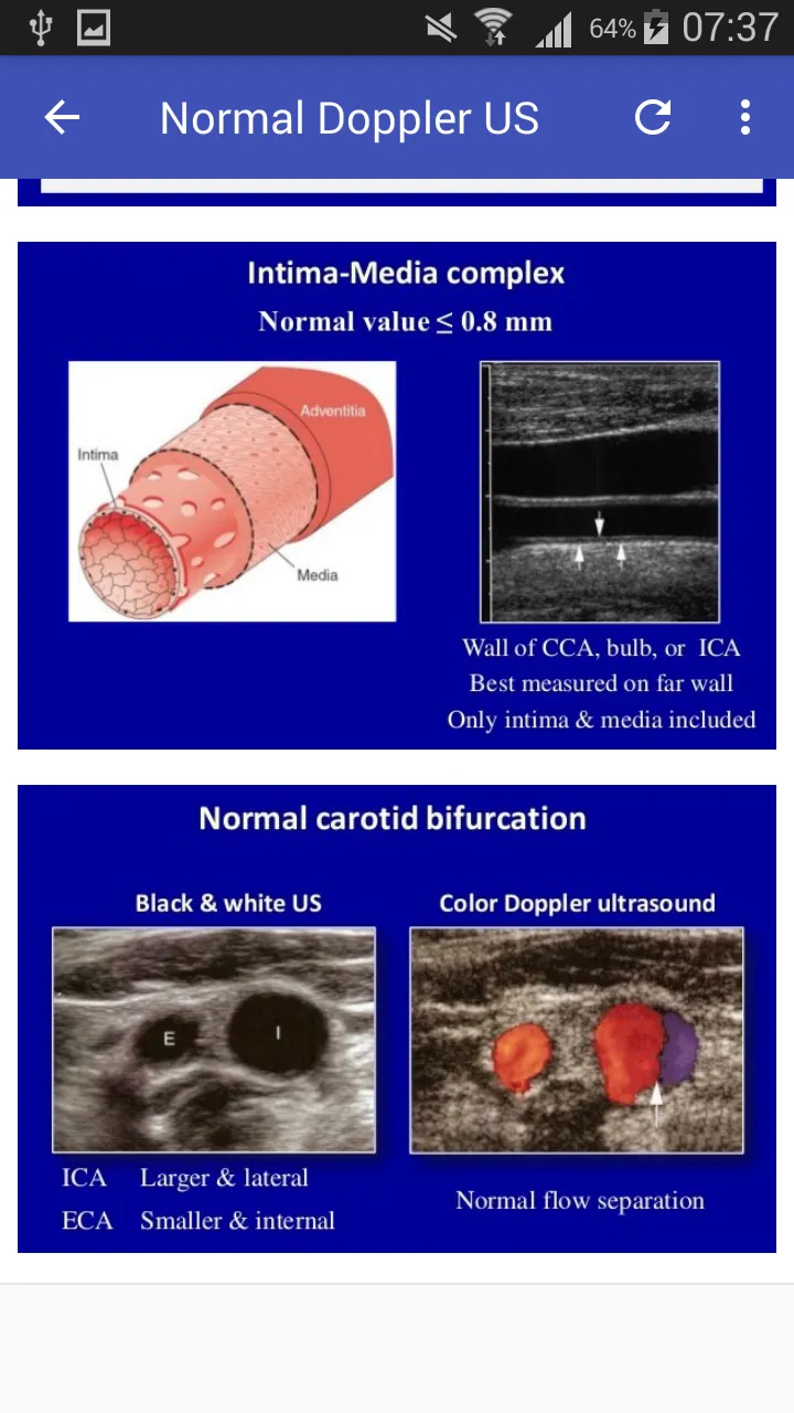 Doppler US Of Carotid arteries | Indus Appstore | Screenshot