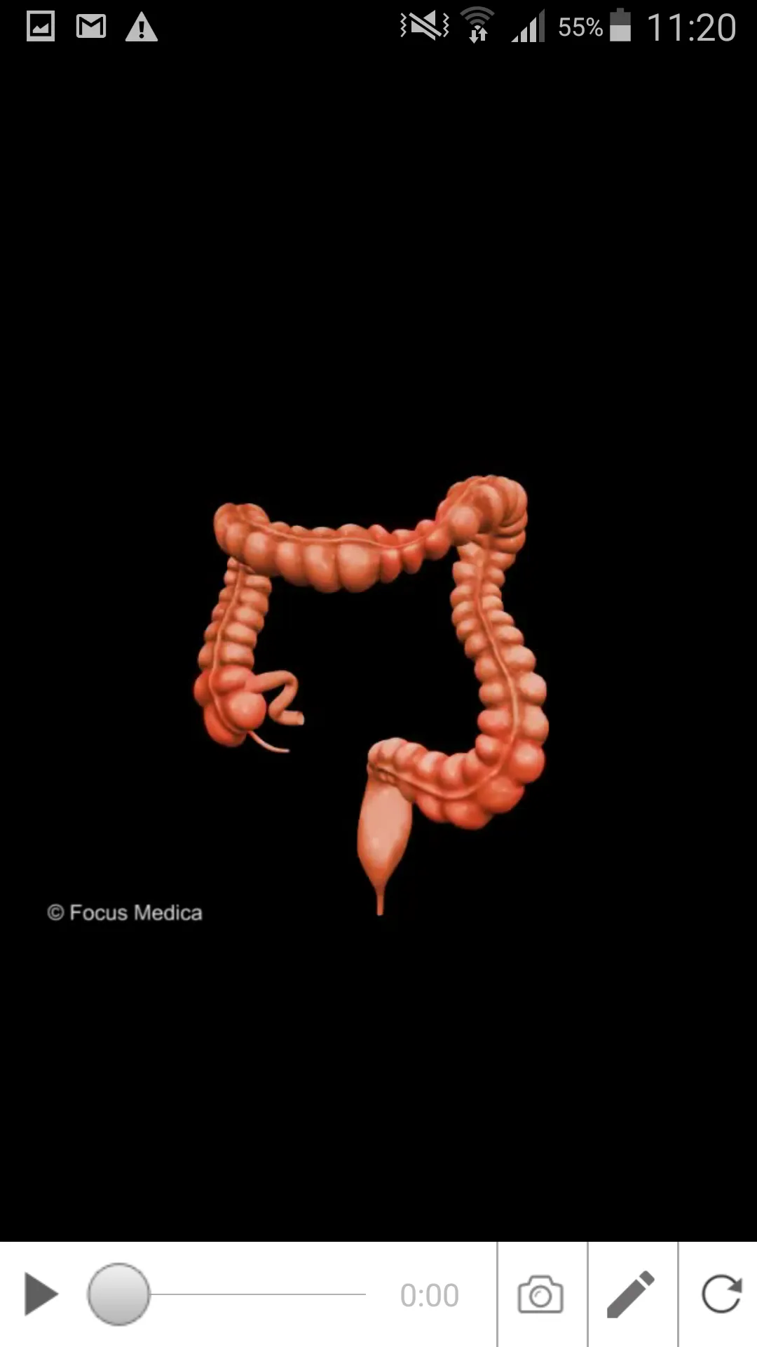 Inflammatory Bowel Disease | Indus Appstore | Screenshot