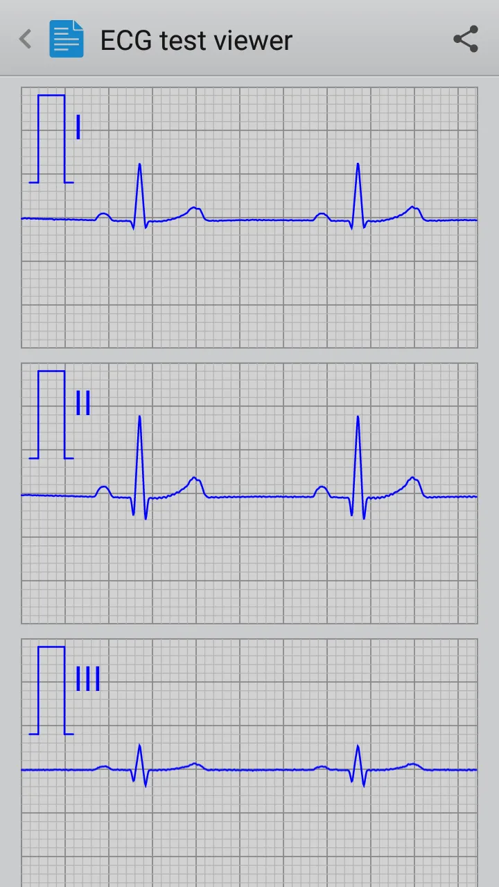 Istel ECG | Indus Appstore | Screenshot