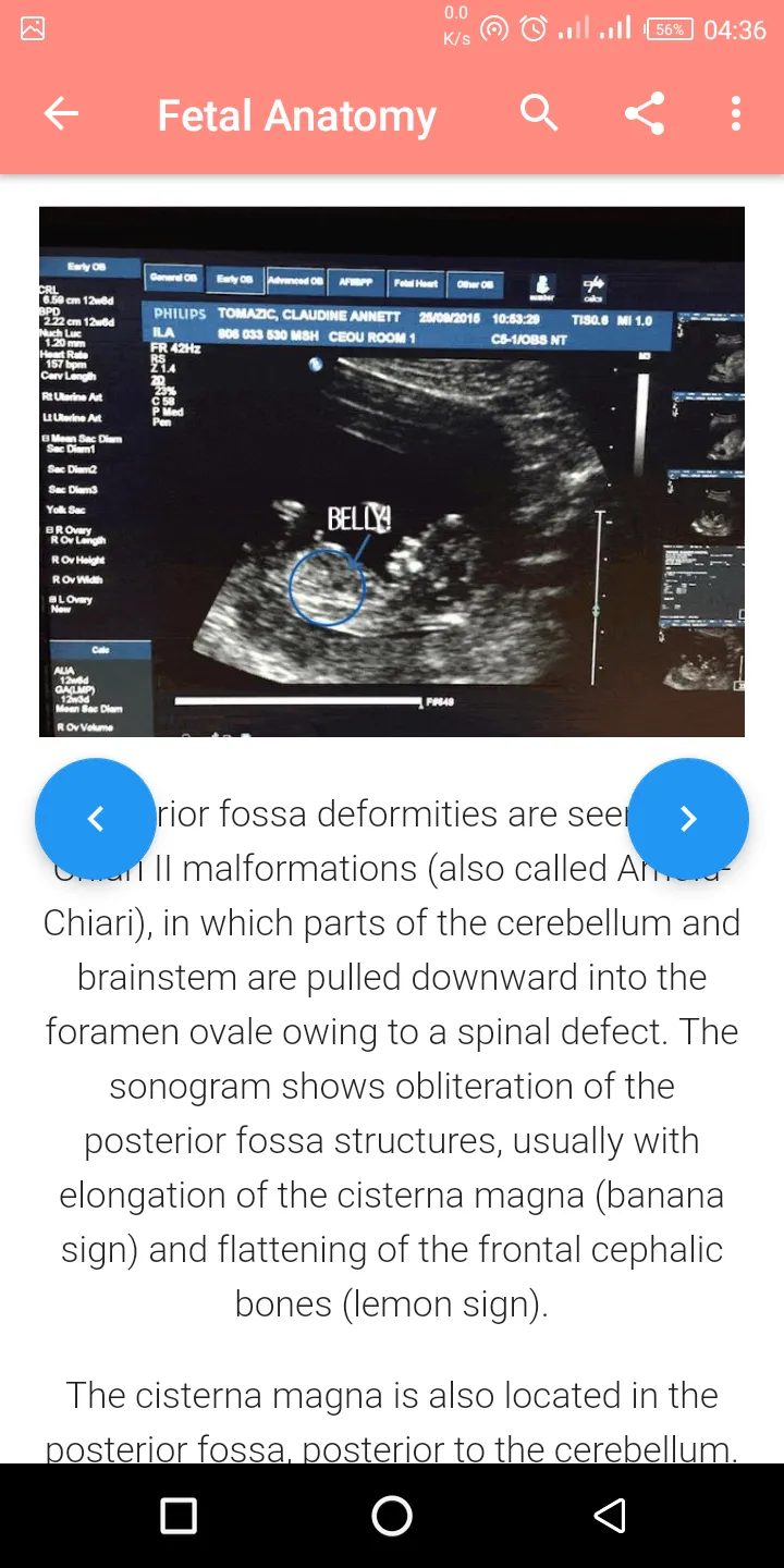 A-Z Obstetrics Ultrasound Guid | Indus Appstore | Screenshot