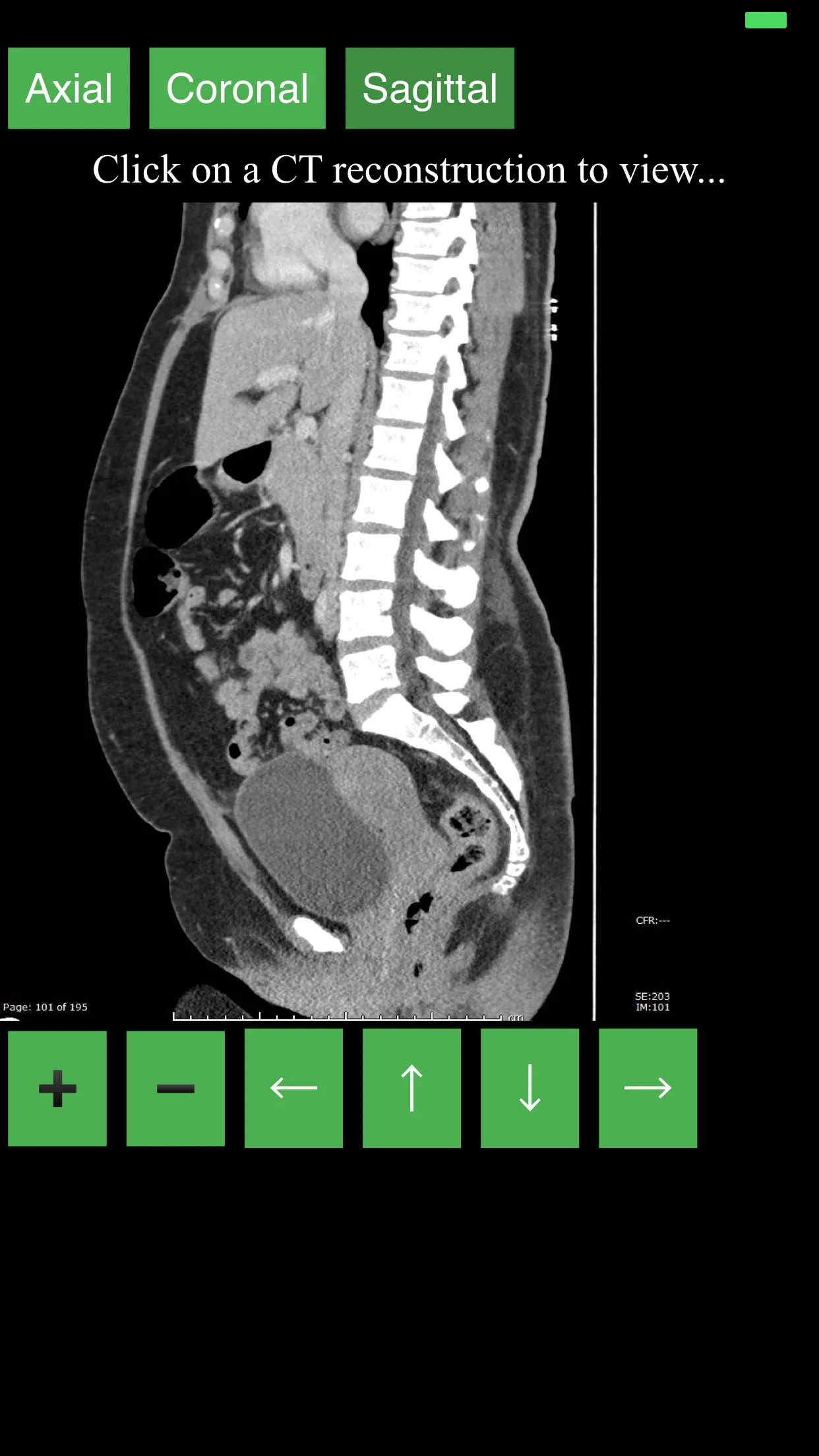 CT Abdomen Pelvis | Indus Appstore | Screenshot