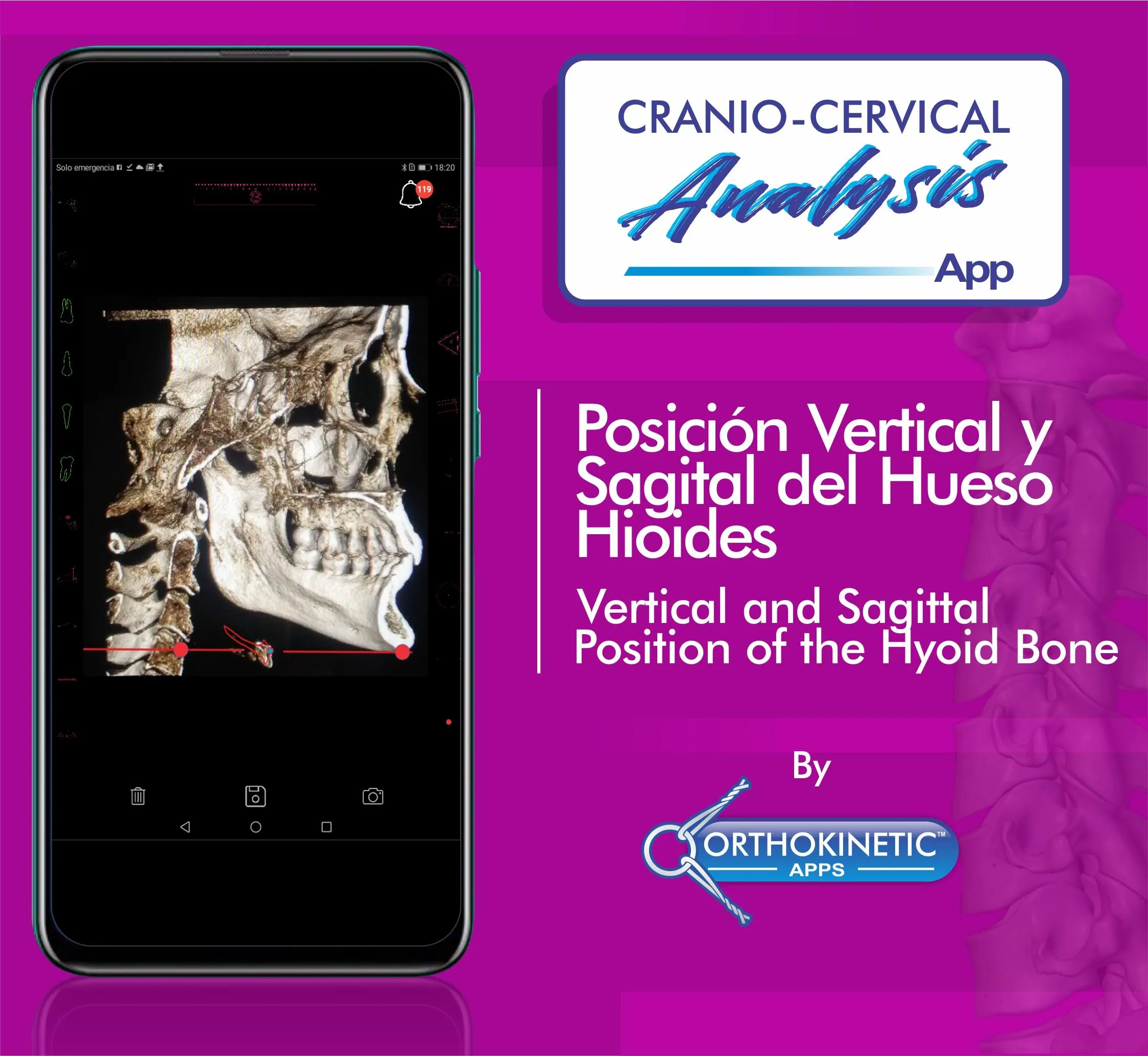 Cranio-cervical Analysis by Or | Indus Appstore | Screenshot