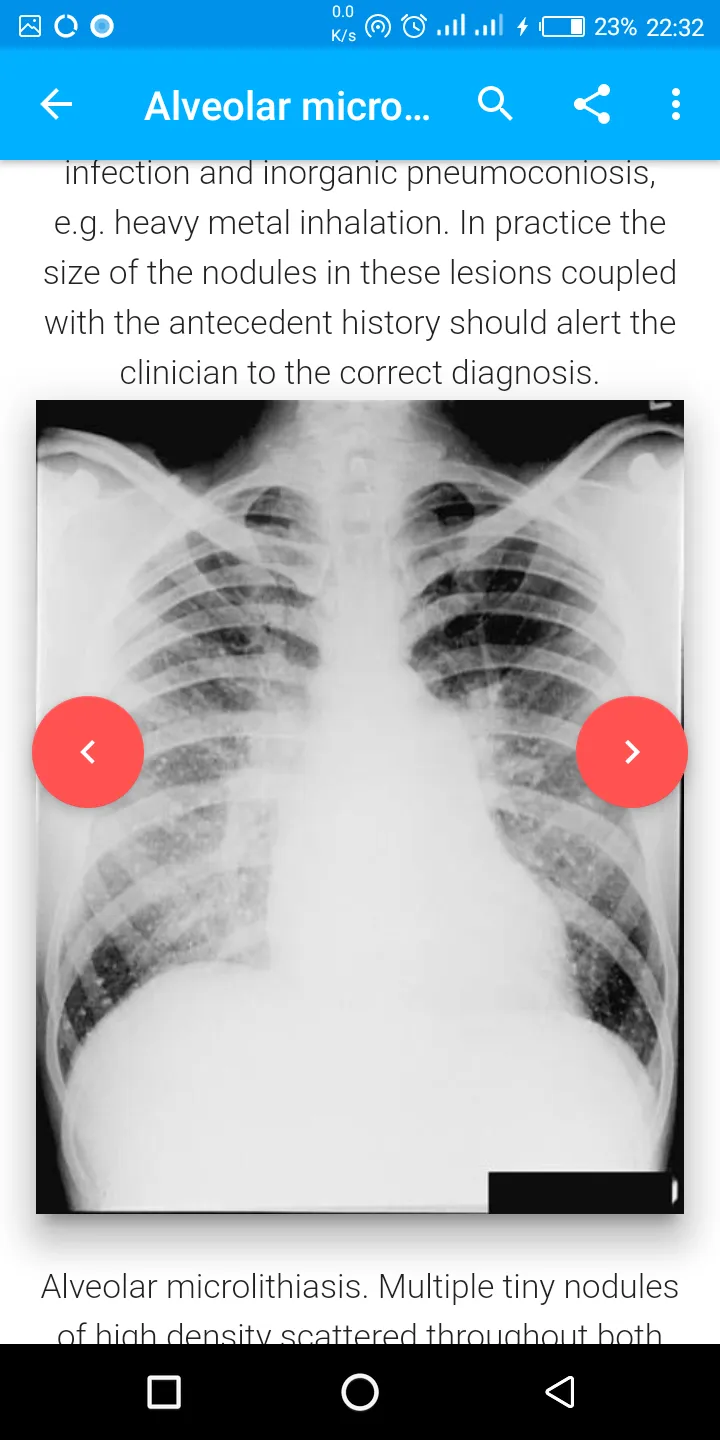 A-Z Chest XRay Pathology Guide | Indus Appstore | Screenshot