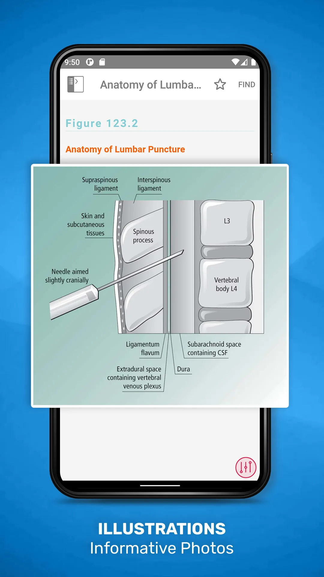 Acute Medicine | Indus Appstore | Screenshot